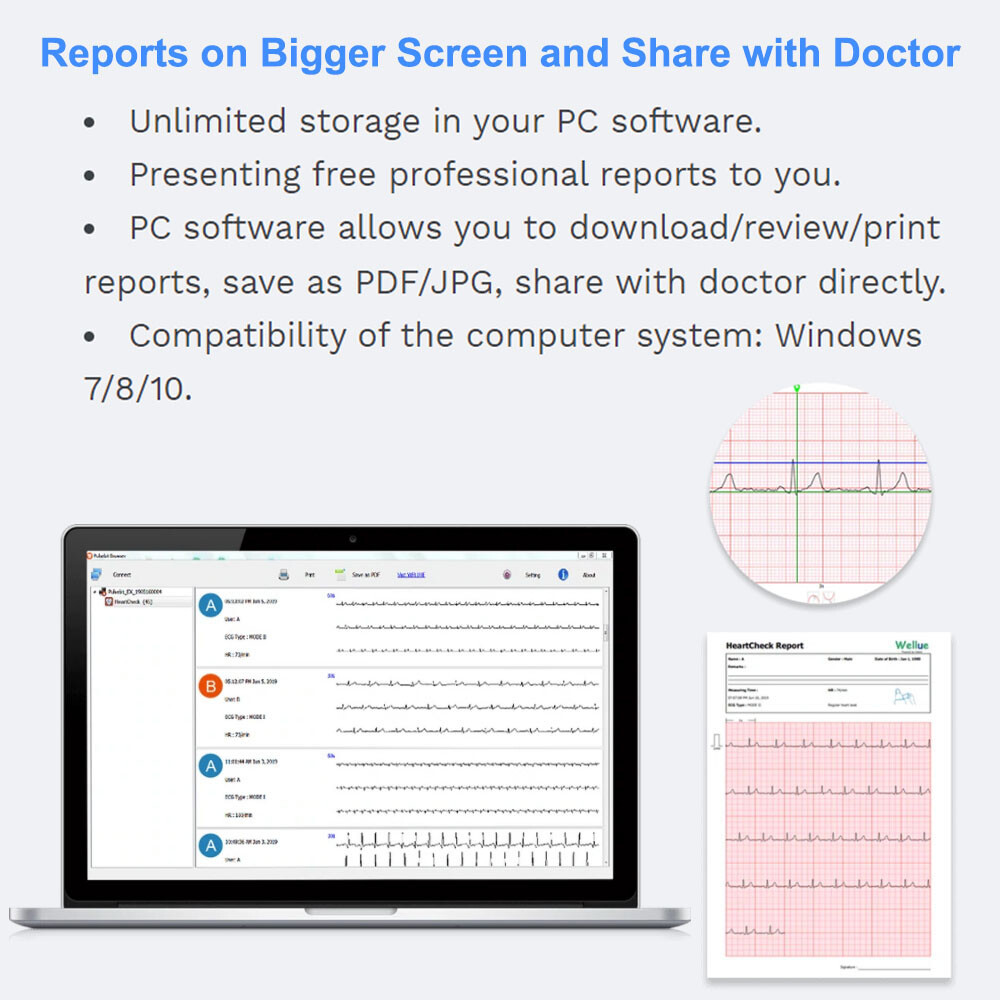 Touch Screen EKG Monitor Heart Monitor with ECG Cable AI-ECG Analysis via App