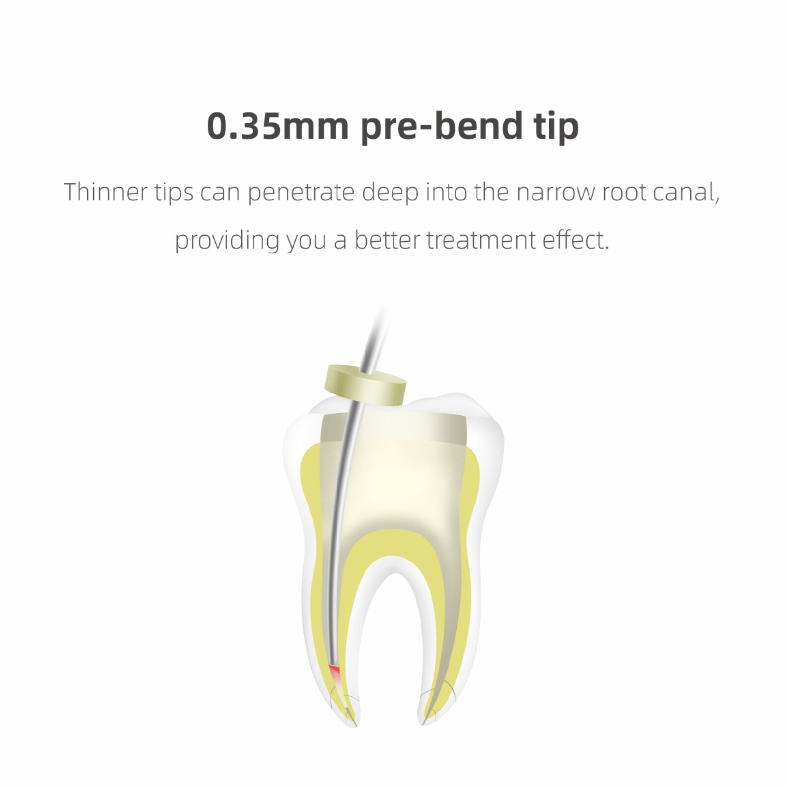 Woodpecker Dental Endo Obturation System Fi-P Gutta Percha Heated Pen Cordless