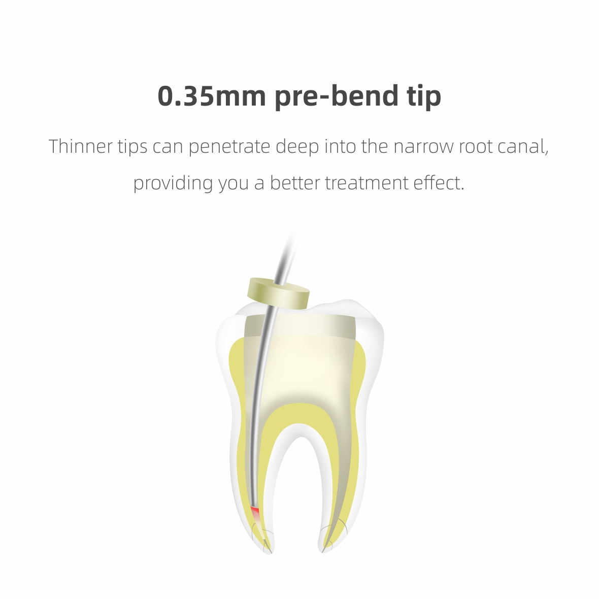 Woodpecker Dental Wireless Gutta Percha Obturation System Endo Heated Pen Fi-P