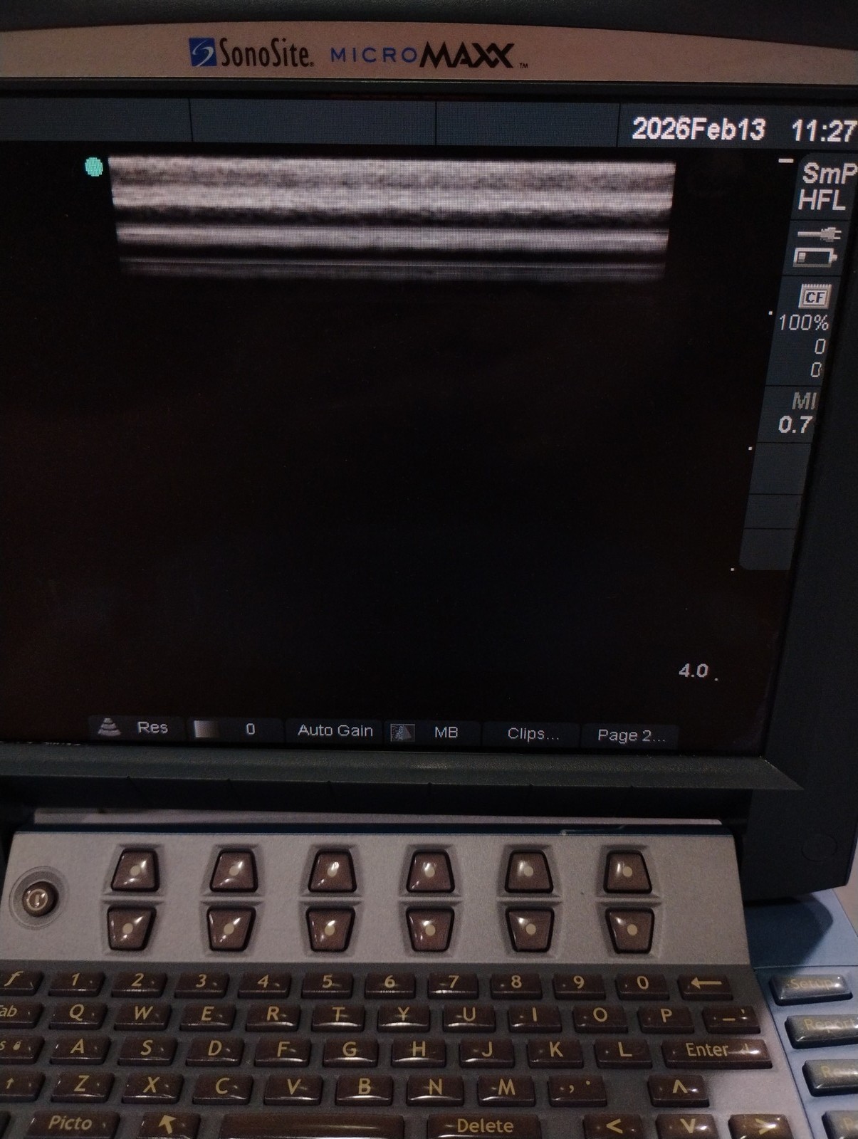 Sonosite HFL38/13-6 MHz Transducer