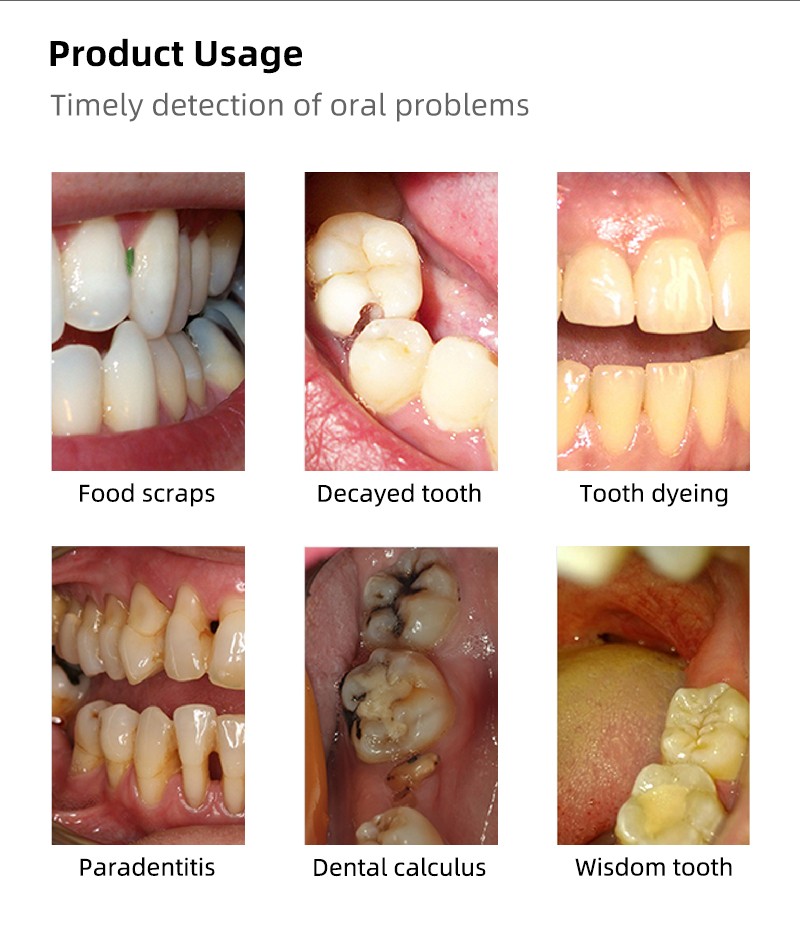 Wireless Dental Intraoral Camera WiFi 3.0 Mega 1080p HD Endoscope Teeth Mirror