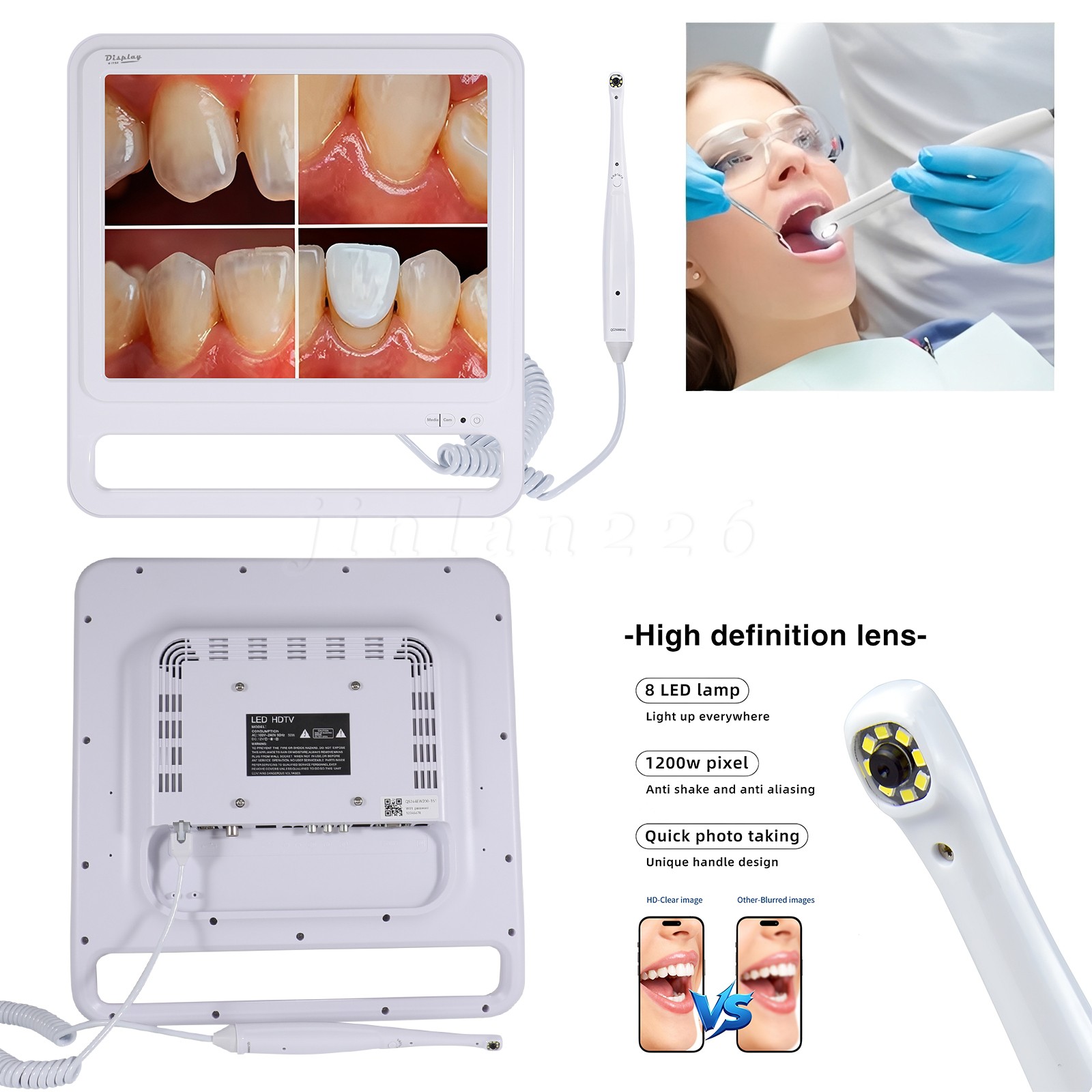 WIFI Dental Intra Oral Camera 17Inch High-Definition Digital LCD Monitor
