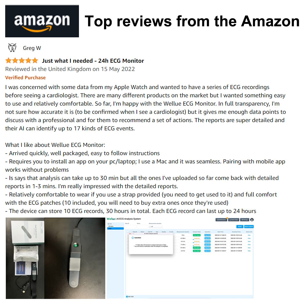 24 hours ECG/EKG Holter Monitor System with AI analysis Detects Afib PC Software