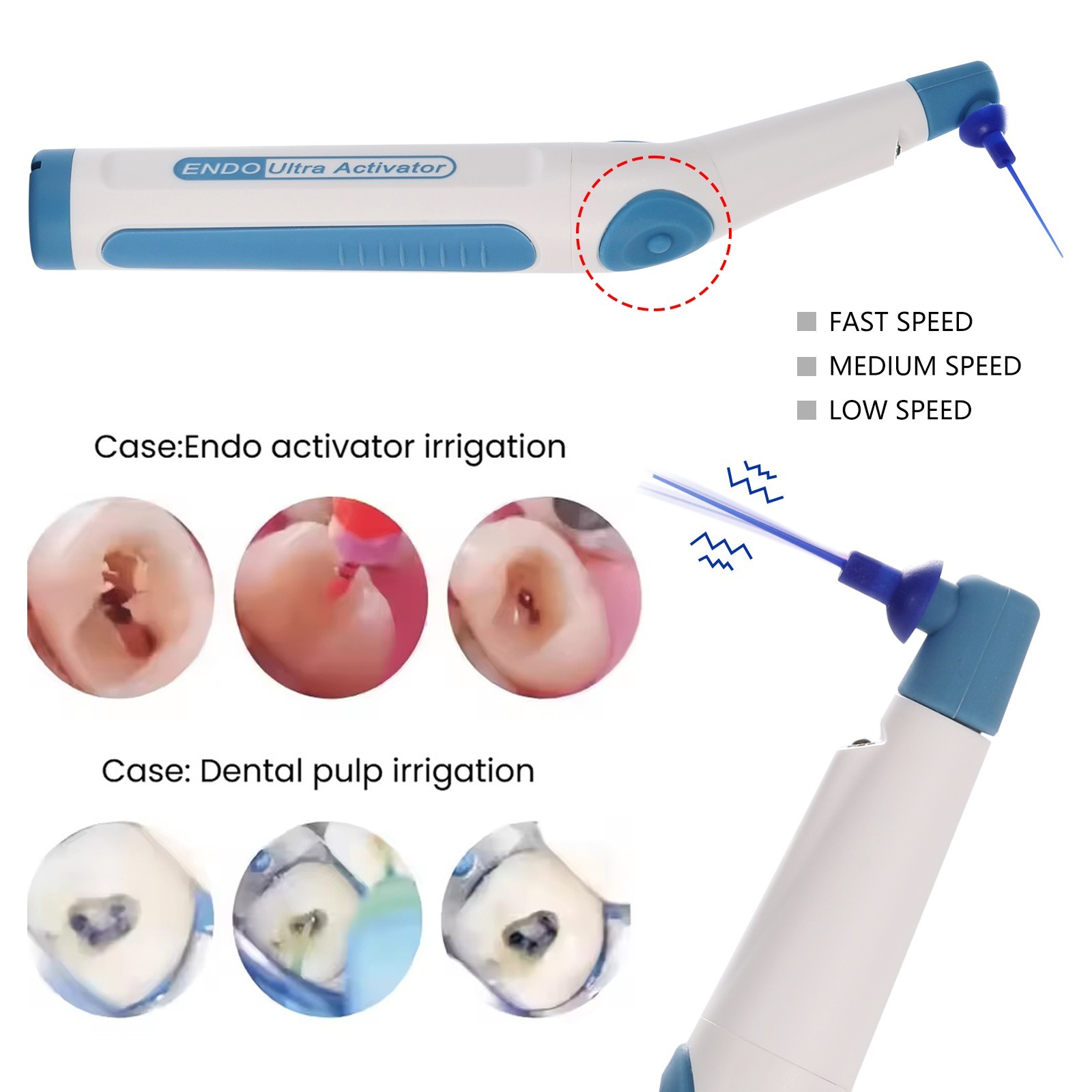 Dental Endodontic Endo Activator Sonic Endo Ultra Irrigator Root Canal +150 Tips