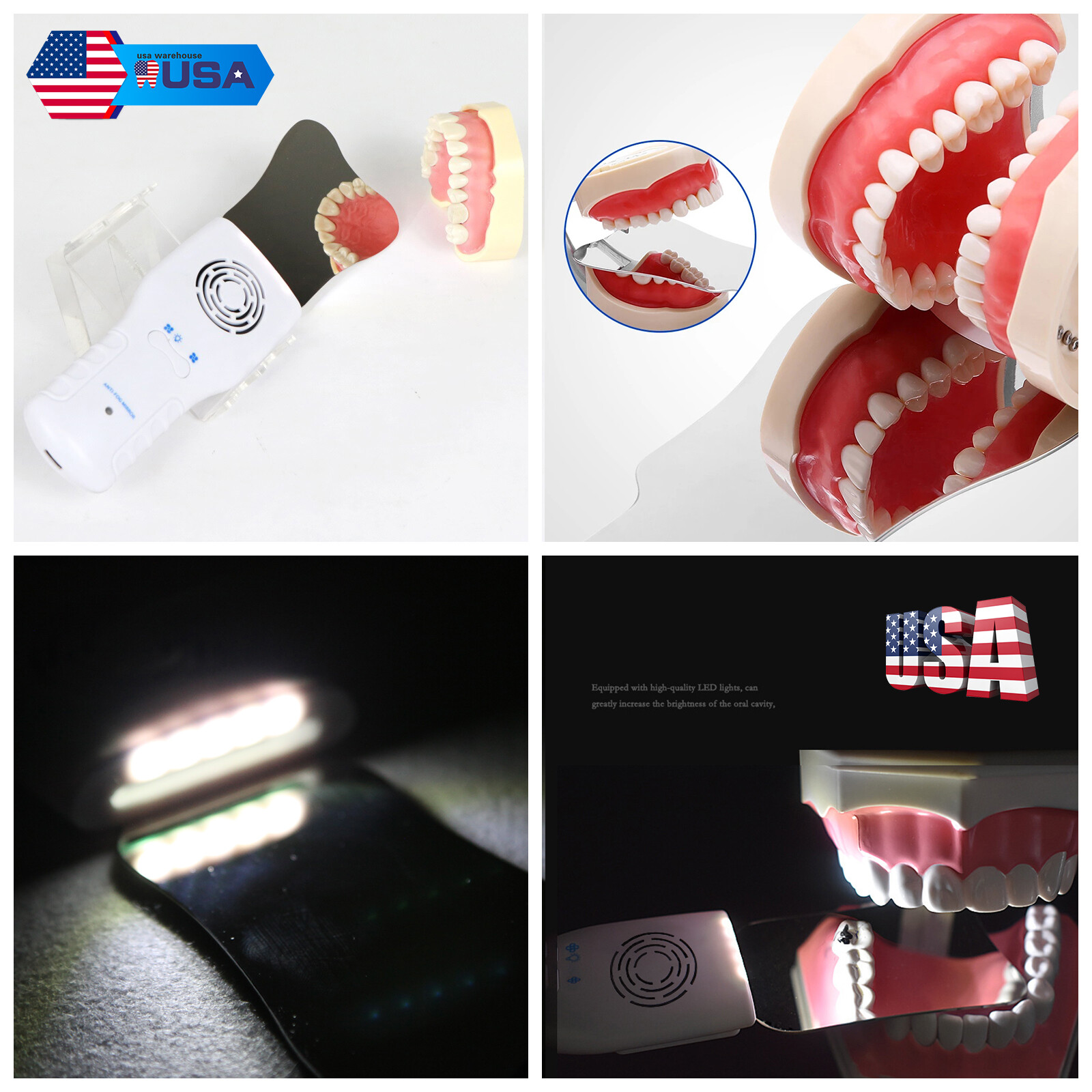 Dental Occlusal Mirror Fog Free LED Intra Oral Photo System 3 Mirrors Anti-Fog