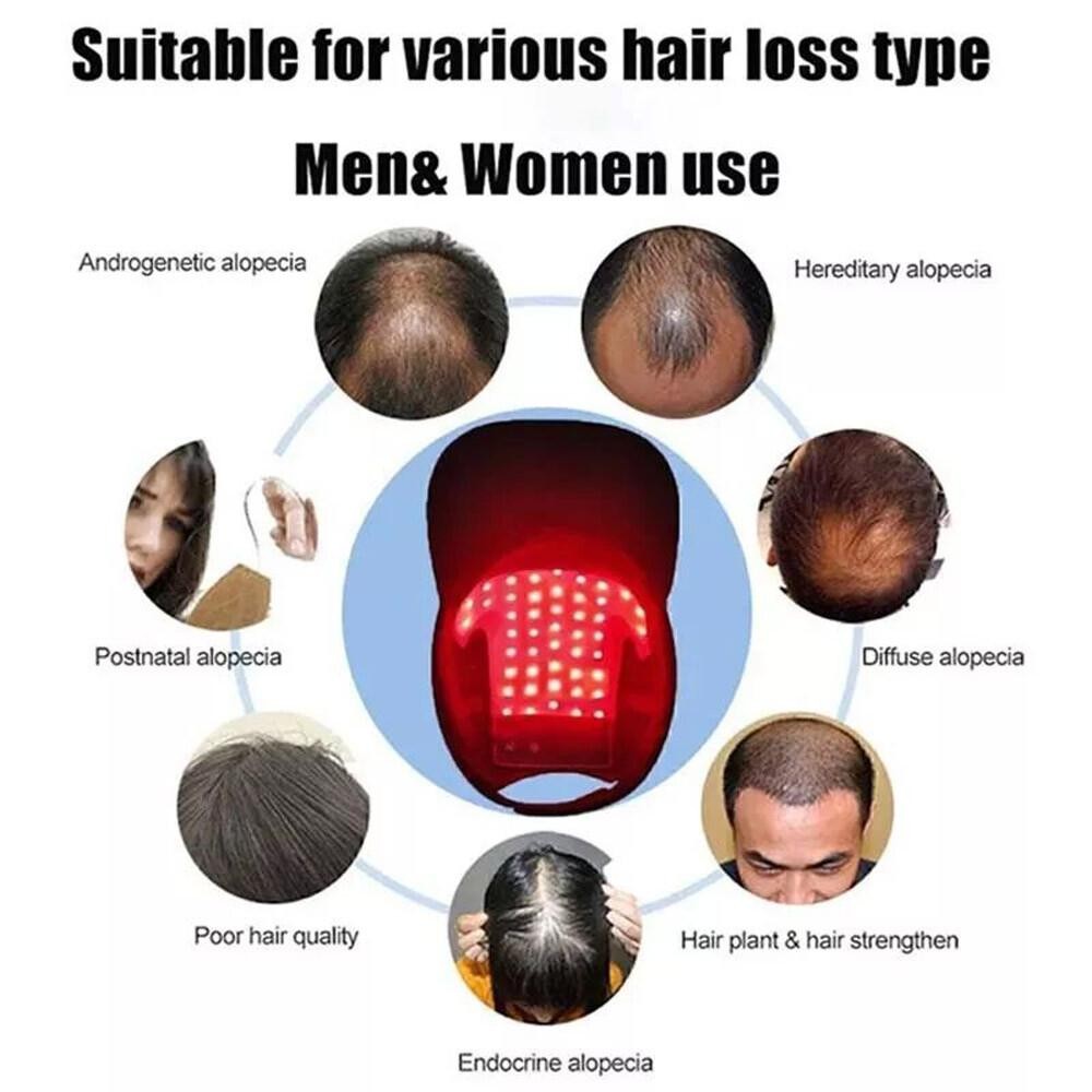 US 650nm Red LED Light Therapy Hat Hair Loss Treatment Cap Hair Growth Regrowth