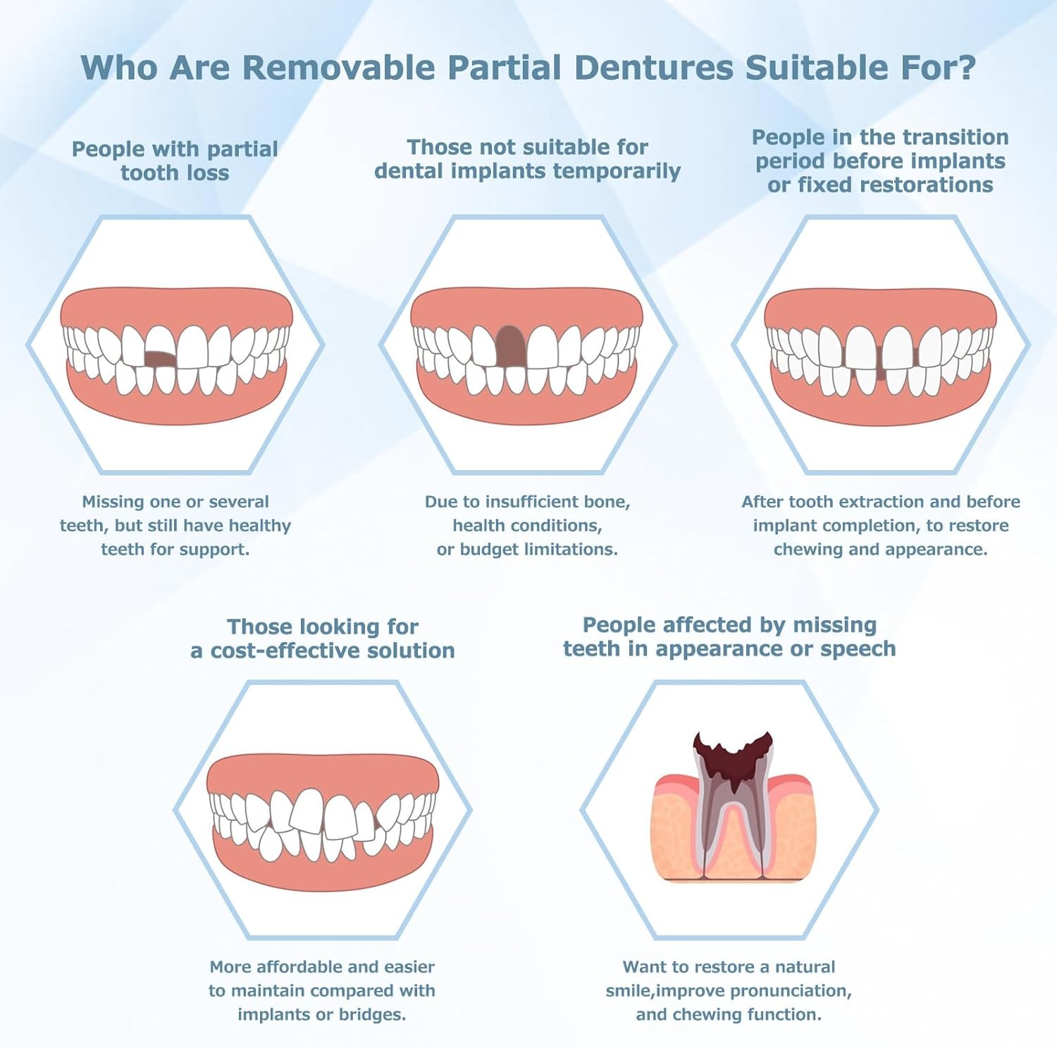 Partial Dentures for Women & Men, Custom Replacement Temporary Flipper Teeth ...
