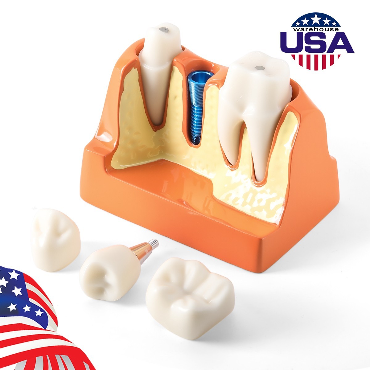 Dental 4 Times Teeth Model Implant Analysis Crown Bridge Demonstration Removable