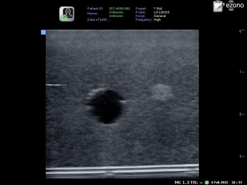 ultrasound phantom training model