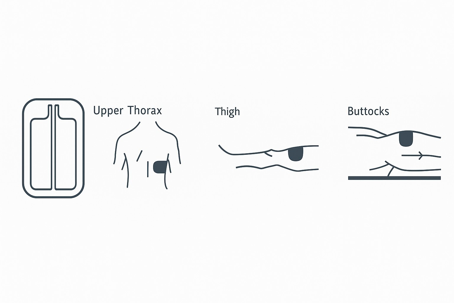 Electrosurgical Grounding Pads - Bovie Pad for Electrocautery Grounding - 40 PCS