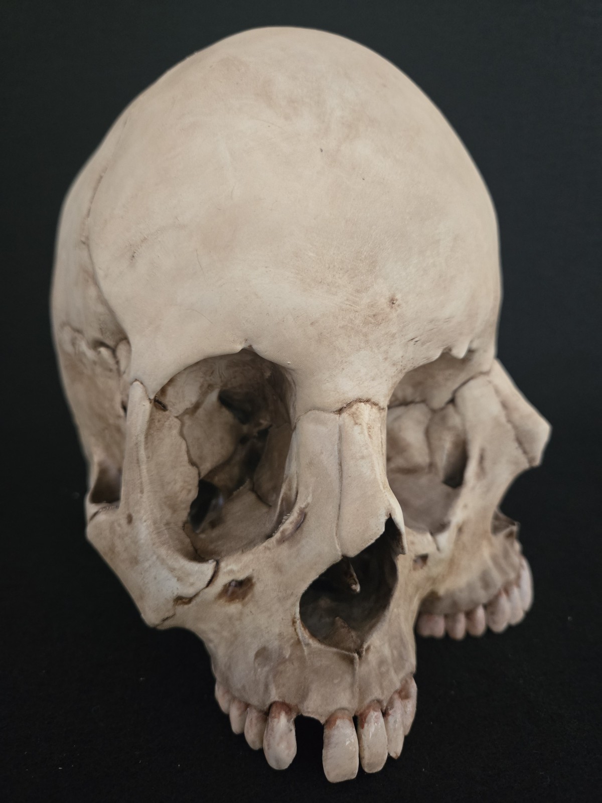 Human Skull - Triclops - Realistic Full Adult Size