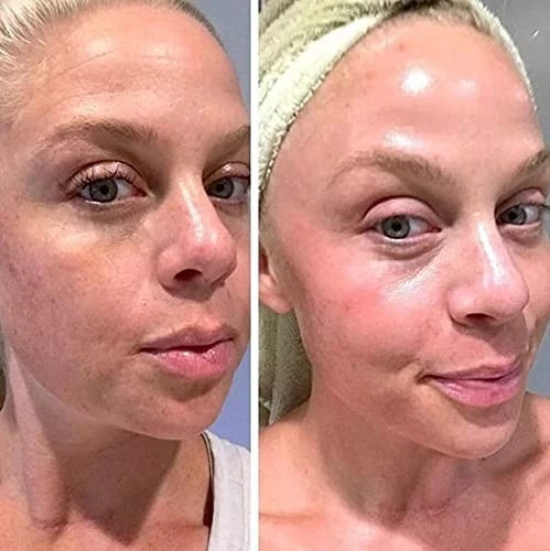 Retinol Gel 0.1 Vitamin a Repairs Fine Lines & Wrinkles, Scar Treatment, Age 20g