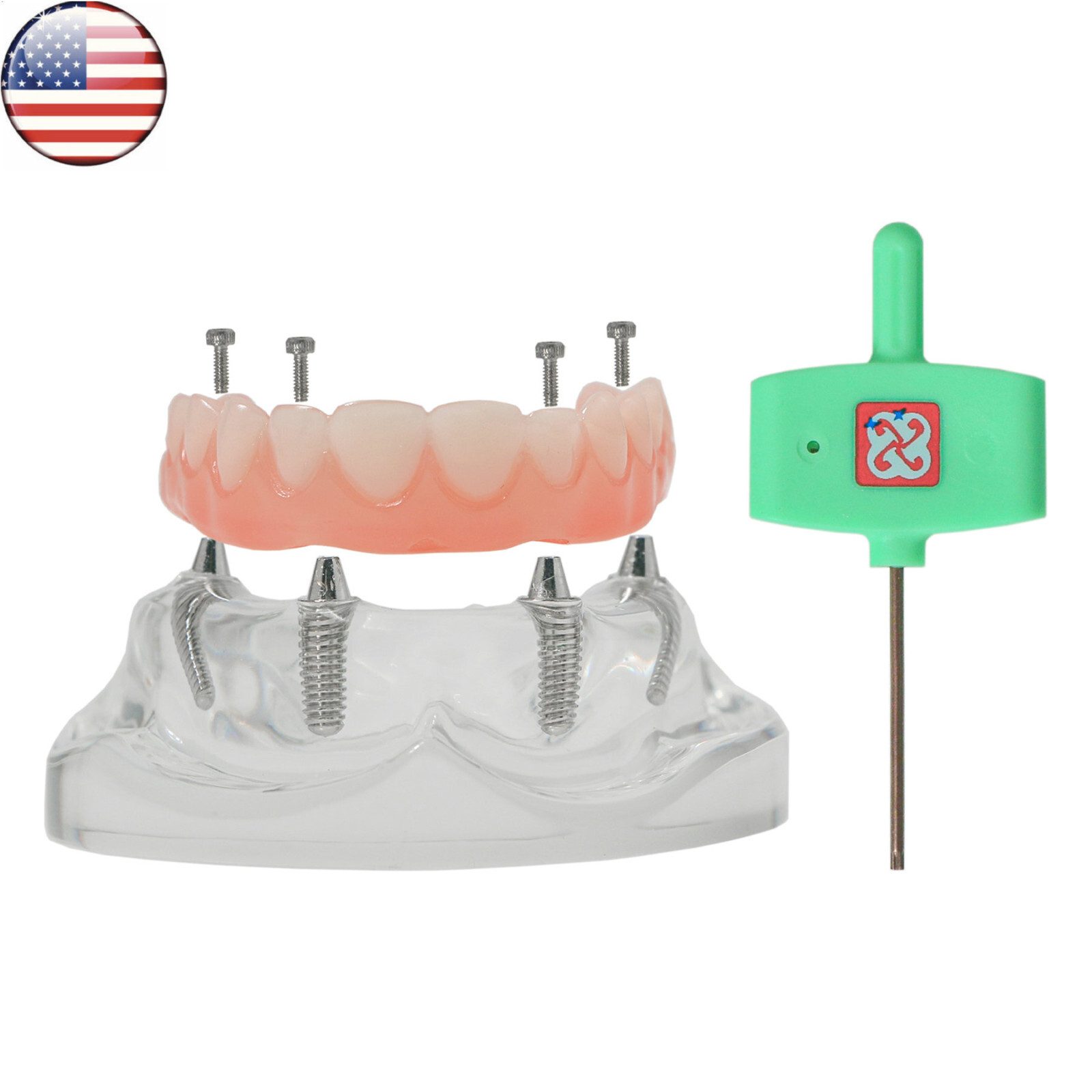 US Dental All-on-4/6 Screws Overdenture Implant Model Upper Jaw Restoration