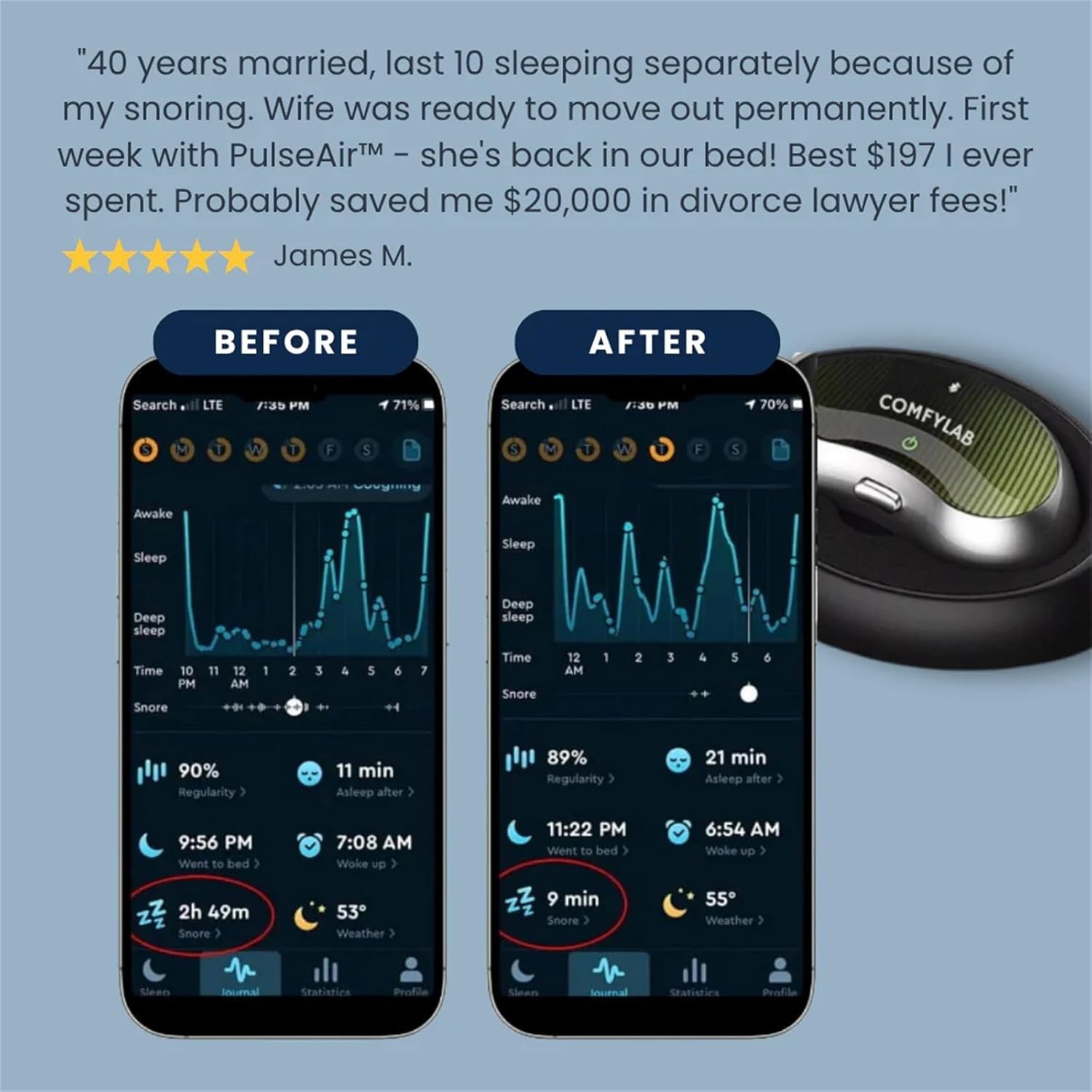 Comfylab Anti Snoring Neurostimulation Device, Professional Anti Snoring Devices