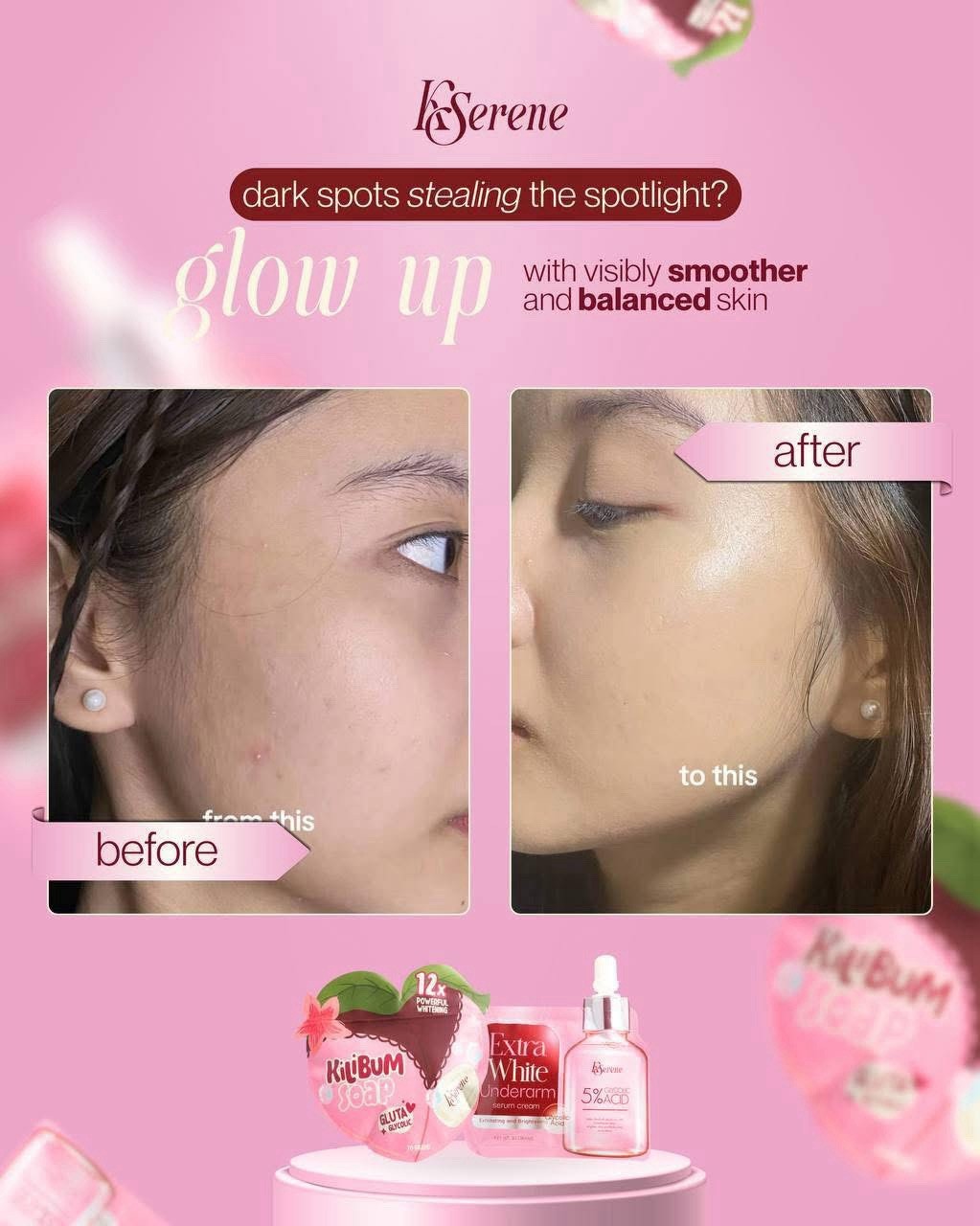 KSerene KiLiBUM Soap 70g x 3 Bars & Extra White Underarm Serum Cream 30ml SET