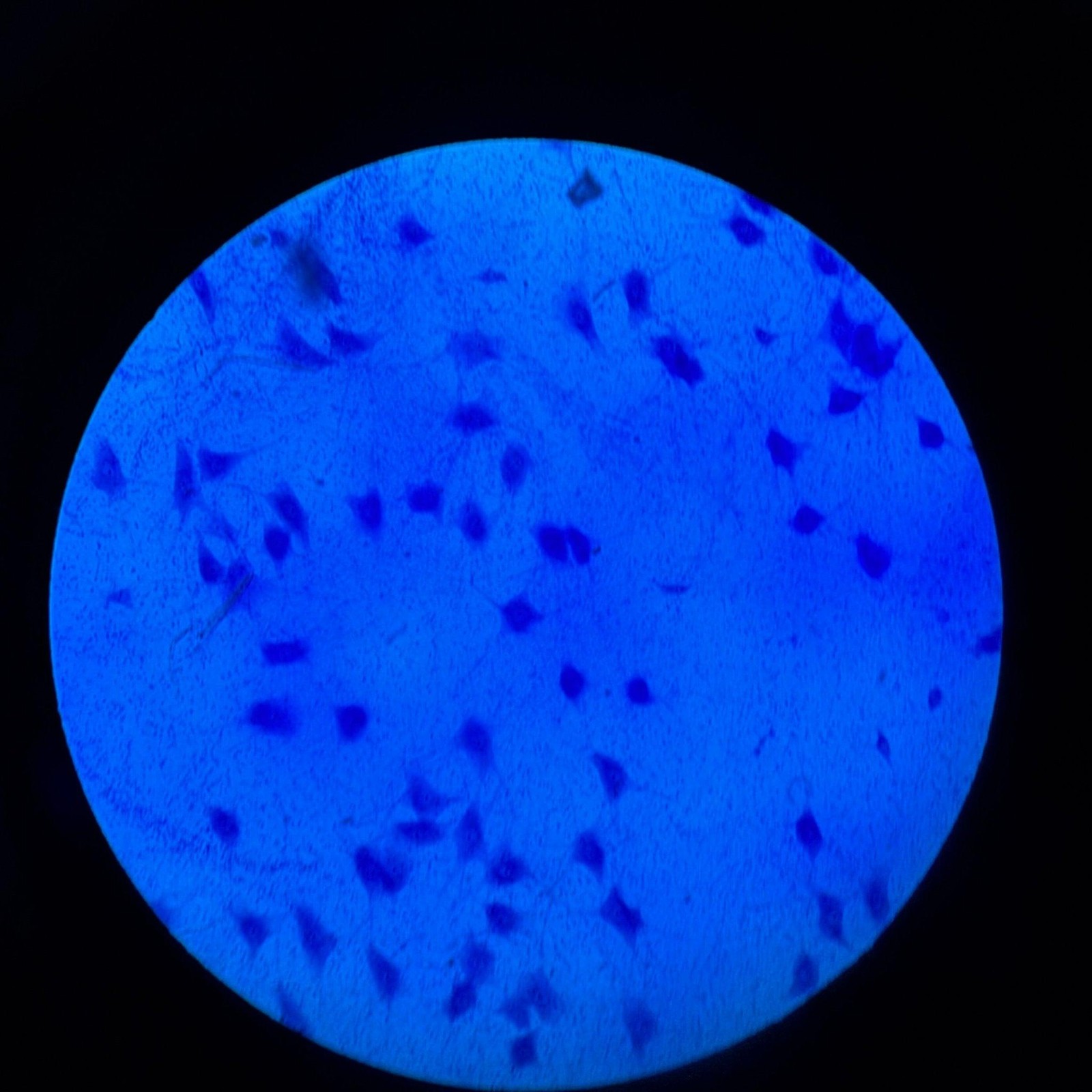 Olympus IX81F-2 Inverted Motorized Microscope w/ IX2-UCB-2 Controller