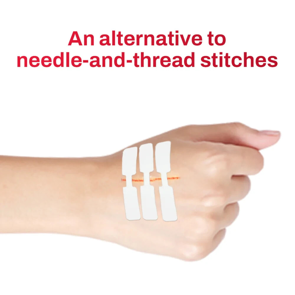 Ever Ready First Aid Sterile Butterfly Wound Closure Large - Box of 100