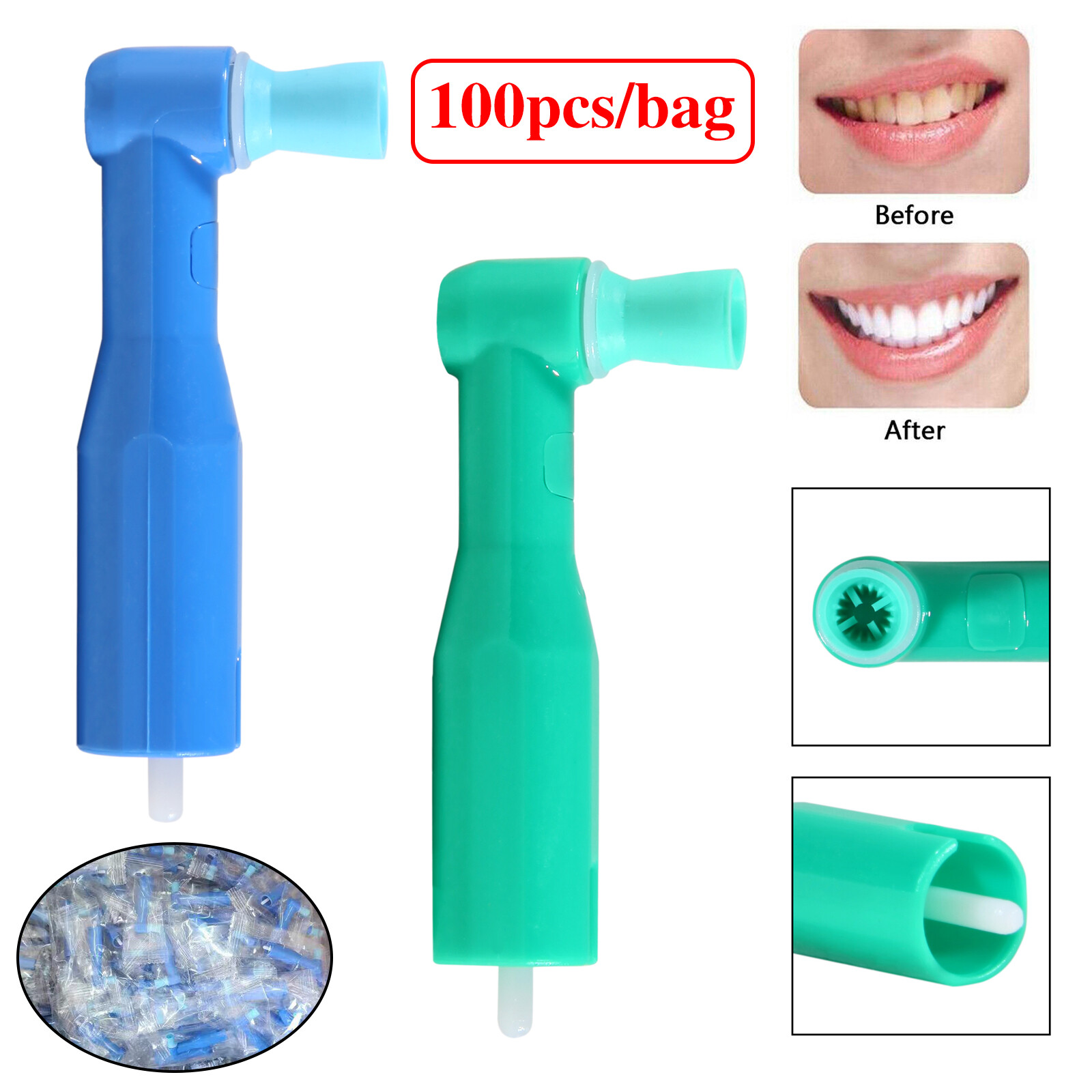 100pcs Dental Disposable Prophy Angles Top Quality Latex Free Soft or Firm OR