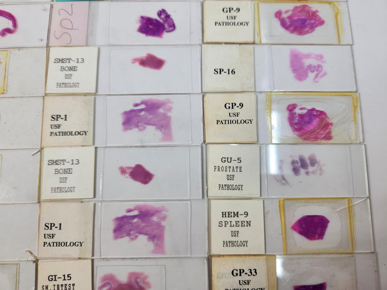 Lot Of 50 Vintage University Prepared Pathology Microscope Slides - Slides Only