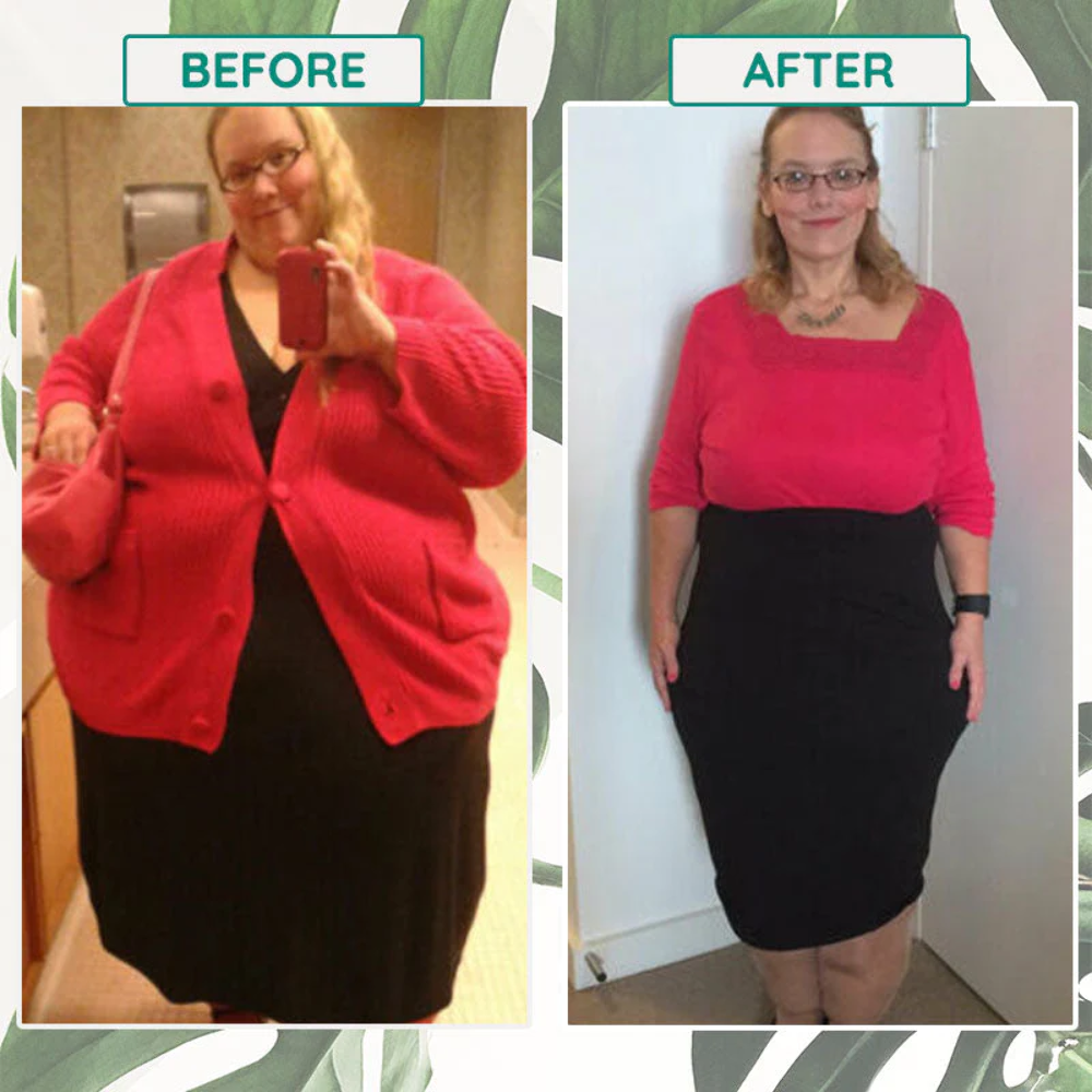 50PCS Slim Patch Weight Loss Slimming Diets Pads Detox Burn Fat Adhesive USA