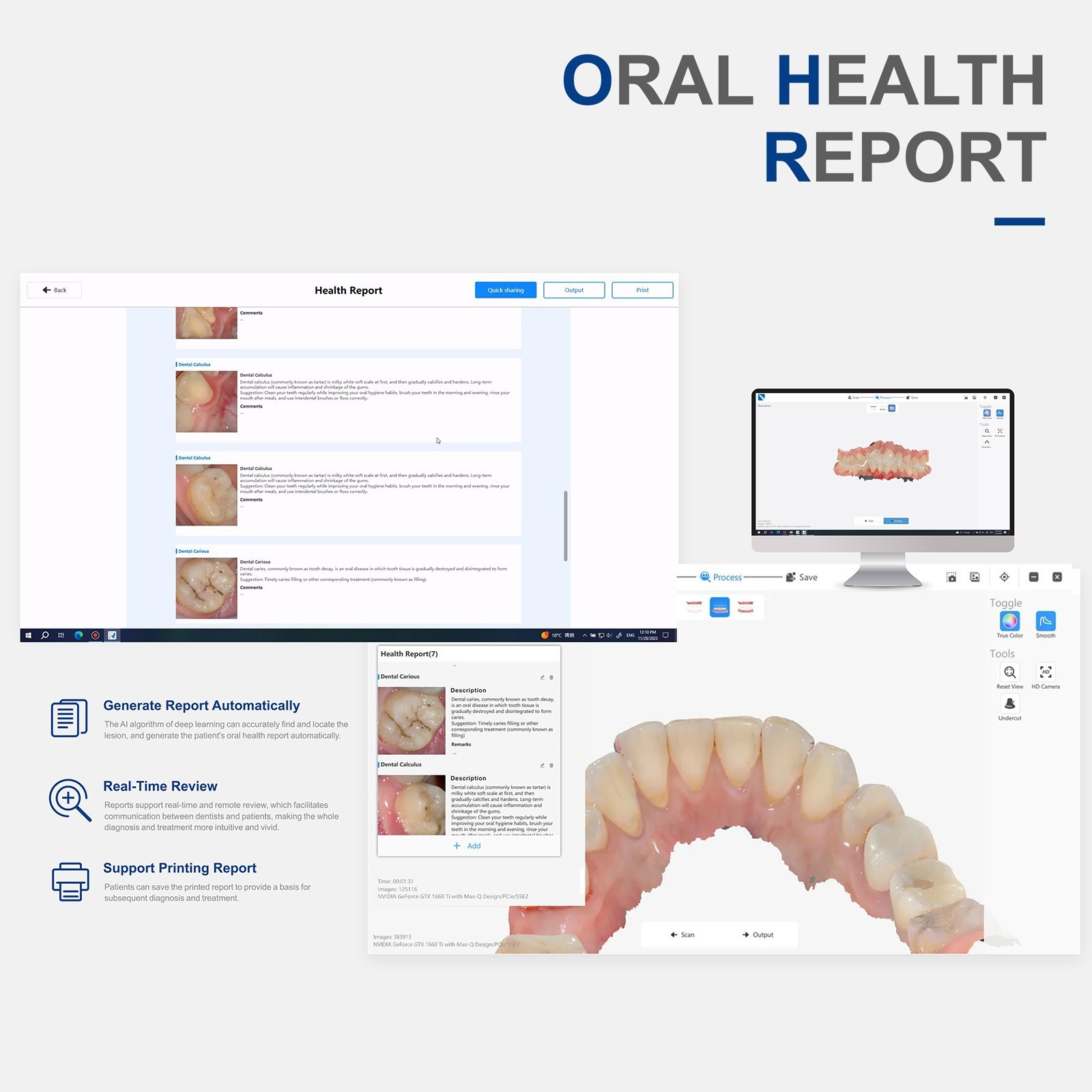 Dental Intra-oral Scanner 3D Real-time Display w/ AI Scanning Software+4 Tips US