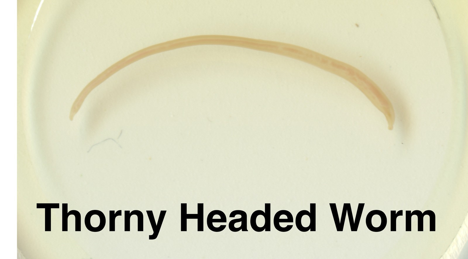 Parasite Microscope Slide Set Deadly Disease Insect Whole Mount Helminth Worm