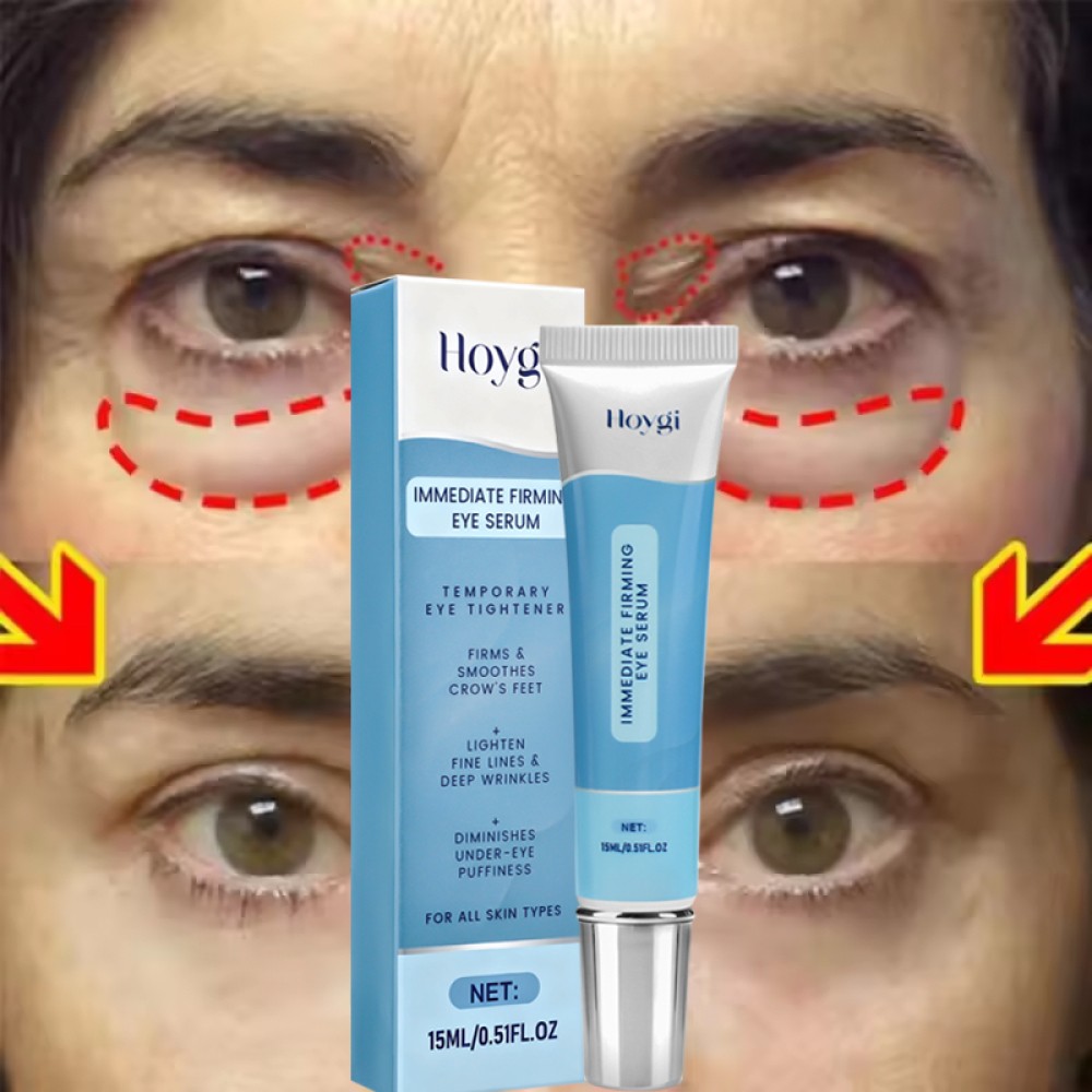 Under Eye Cream Remove Dark Circles Bags Face Lines Ageless Wrinkles Puffy Eye-