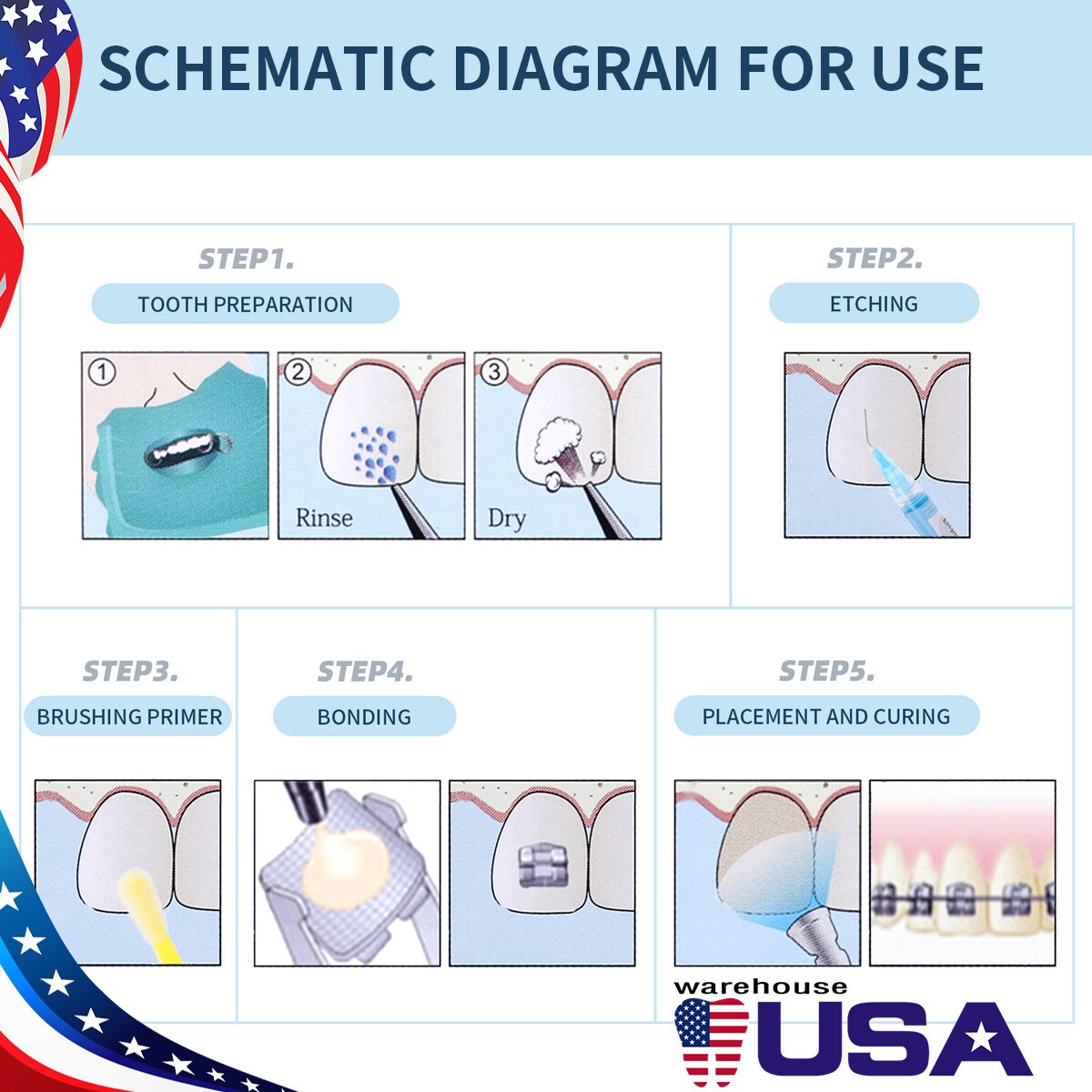 Dental Orthodontic Brackets Light Cure Bonding Adhesive Etch Gel Bonding kit
