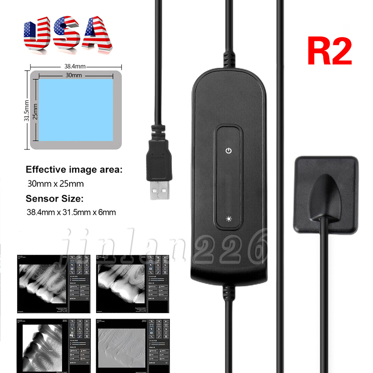 Sensor Dental RVG X-ray Sensor Digital Imaging System 1.5M Holder
