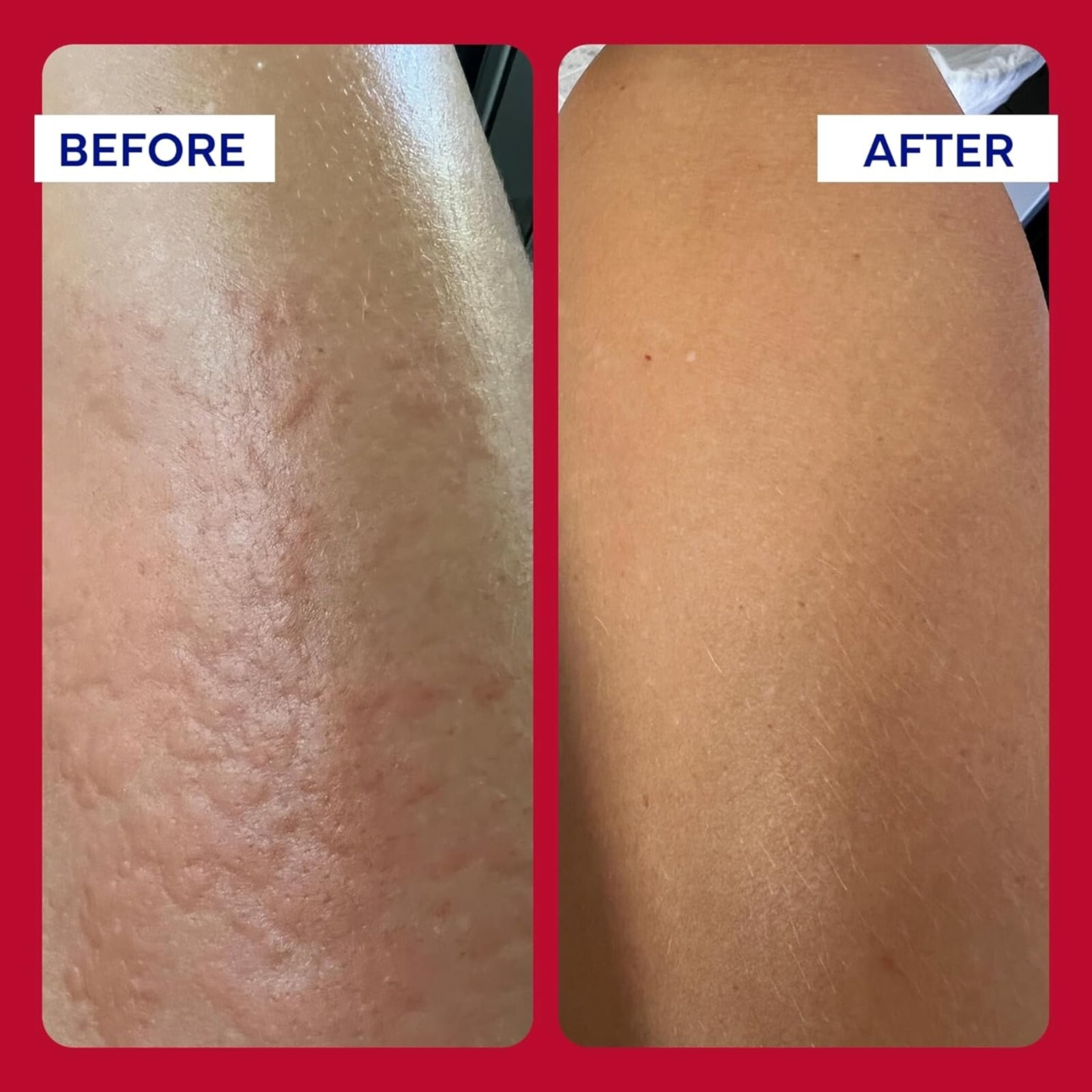 EMUAID Max First Aid Ointment For Reduces Pain, Infection, Inflammation 2oz.