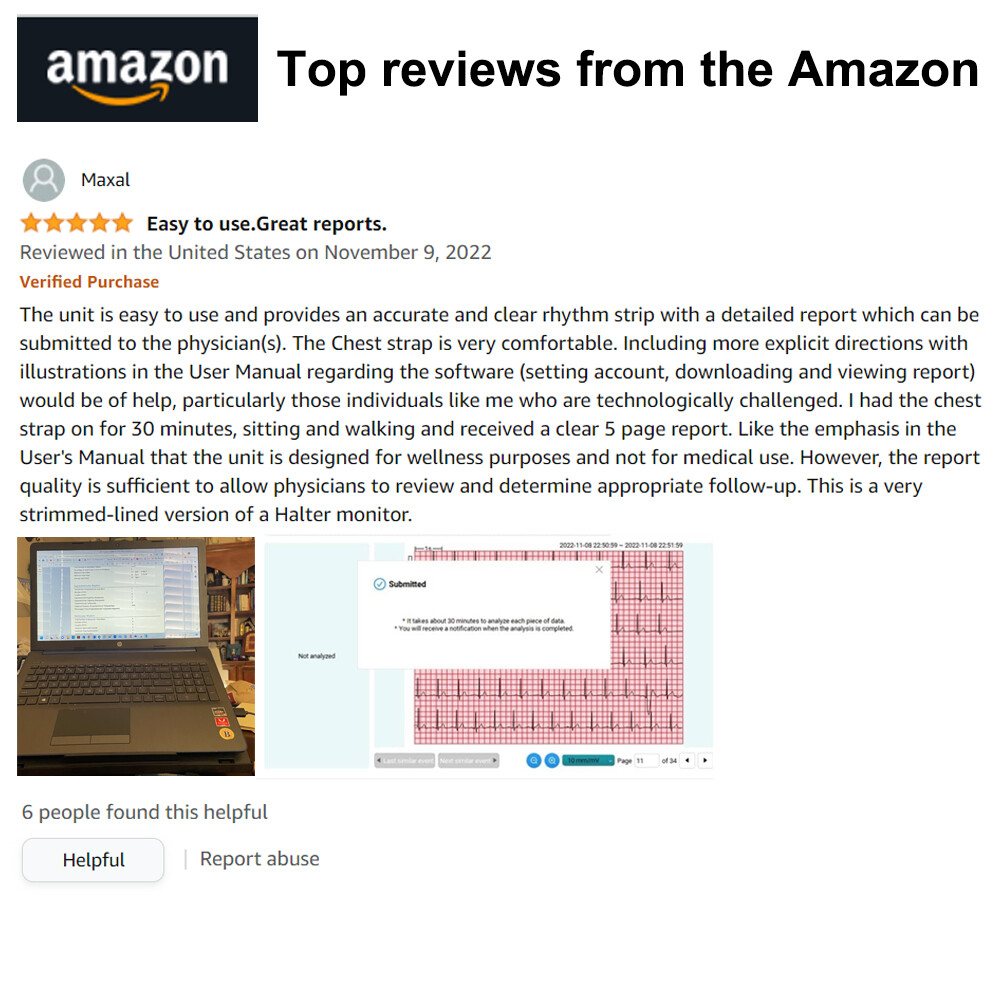 US stock Wellue Portable Dynamic ECG EKG Holter Recorder 24 Hours PC AI analysis