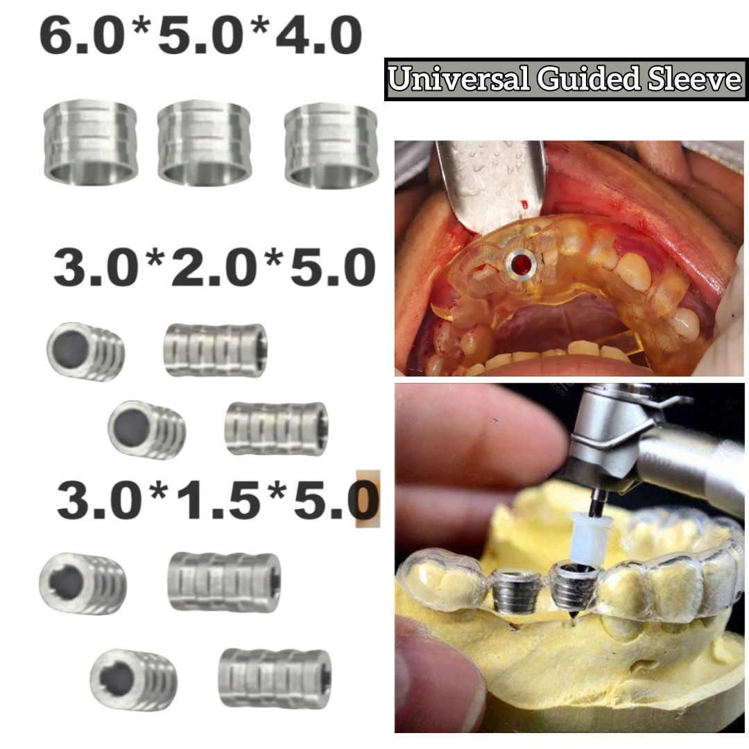 10Pcs Dental Sleeves Digital Implant Planning Template Universal Drills Guided