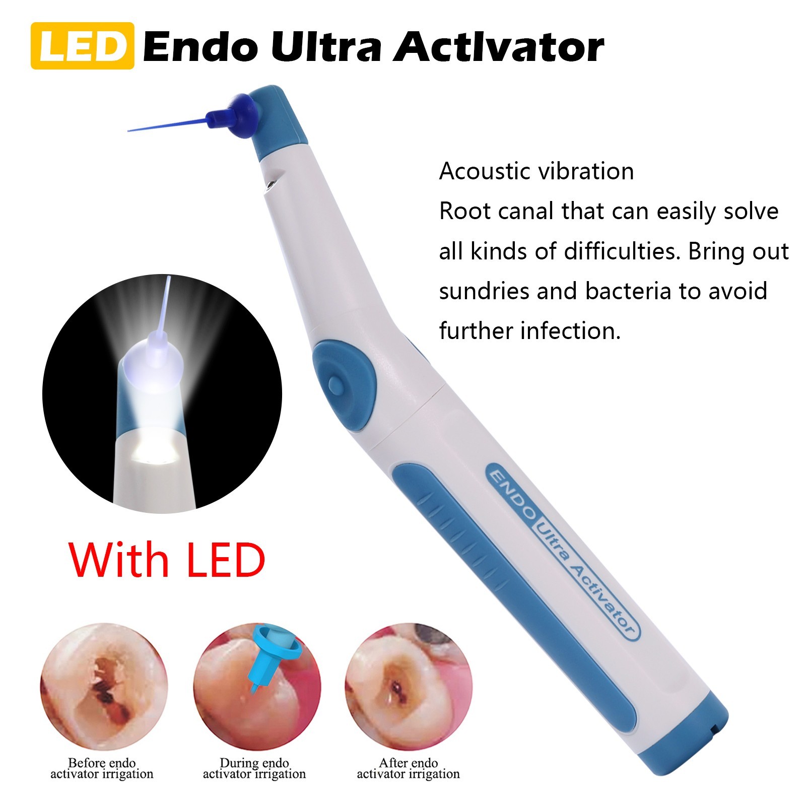 Dental Endodontic Endo Activator Sonic Endo Ultra Irrigator Root Canal +150 Tips