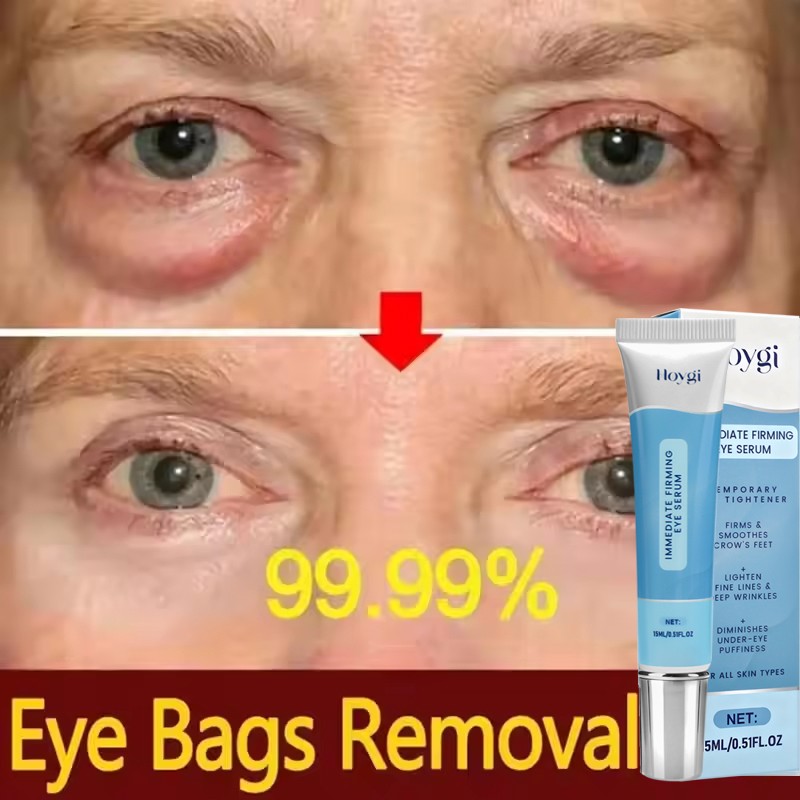 Under Eye Cream Remove Dark Circles Bags Face Lines Ageless Wrinkles Puffy Eye-