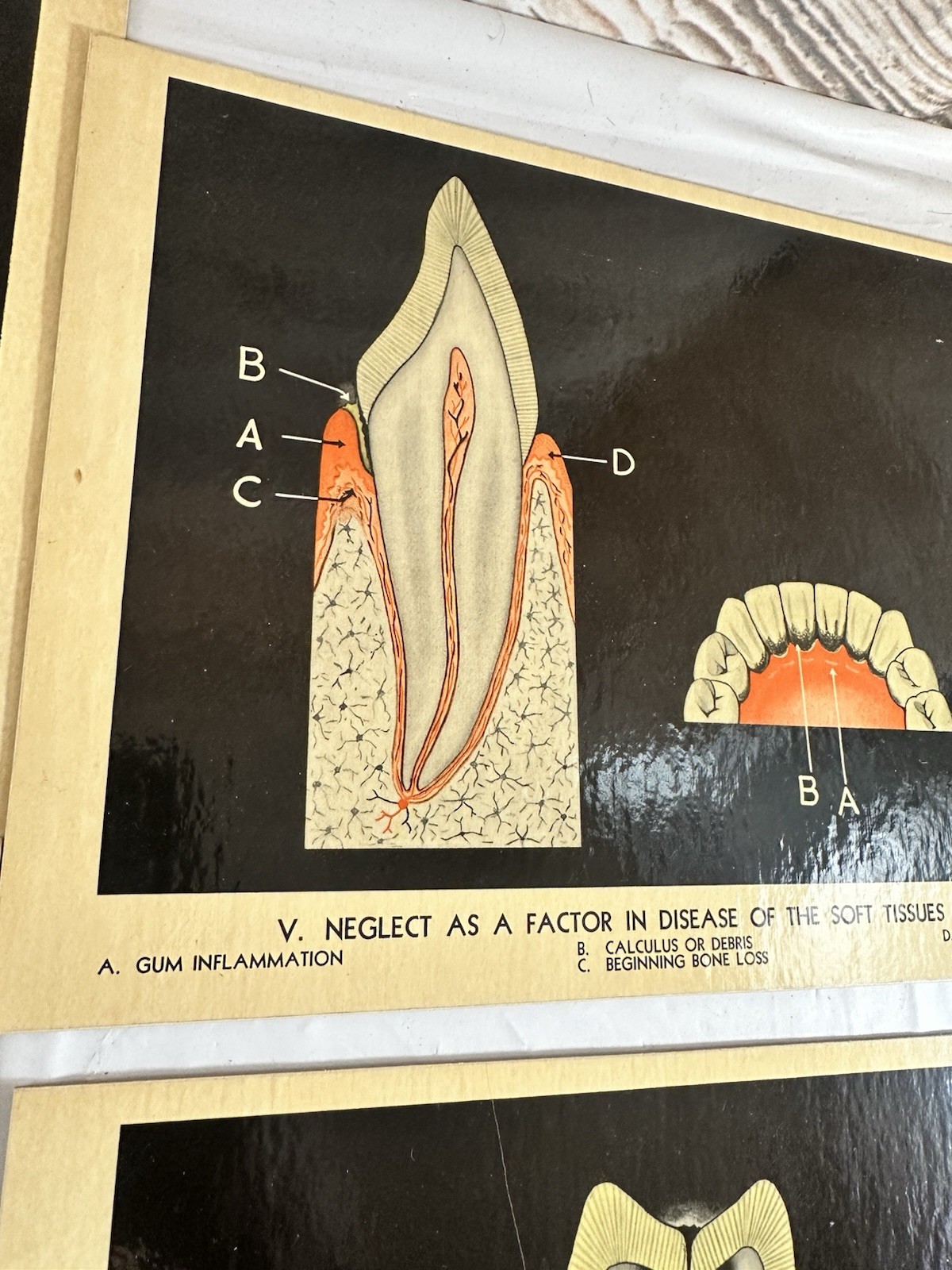 Vintage Lactona Inc Dental Anatomy Diagram Prints 11X8.5 Inches Dentistry