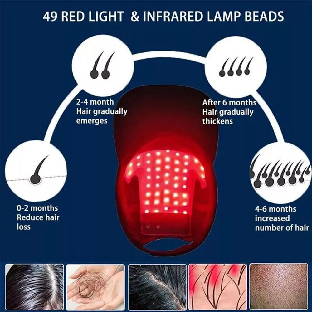 US 650nm Red LED Light Therapy Hat Hair Loss Treatment Cap Hair Growth Regrowth