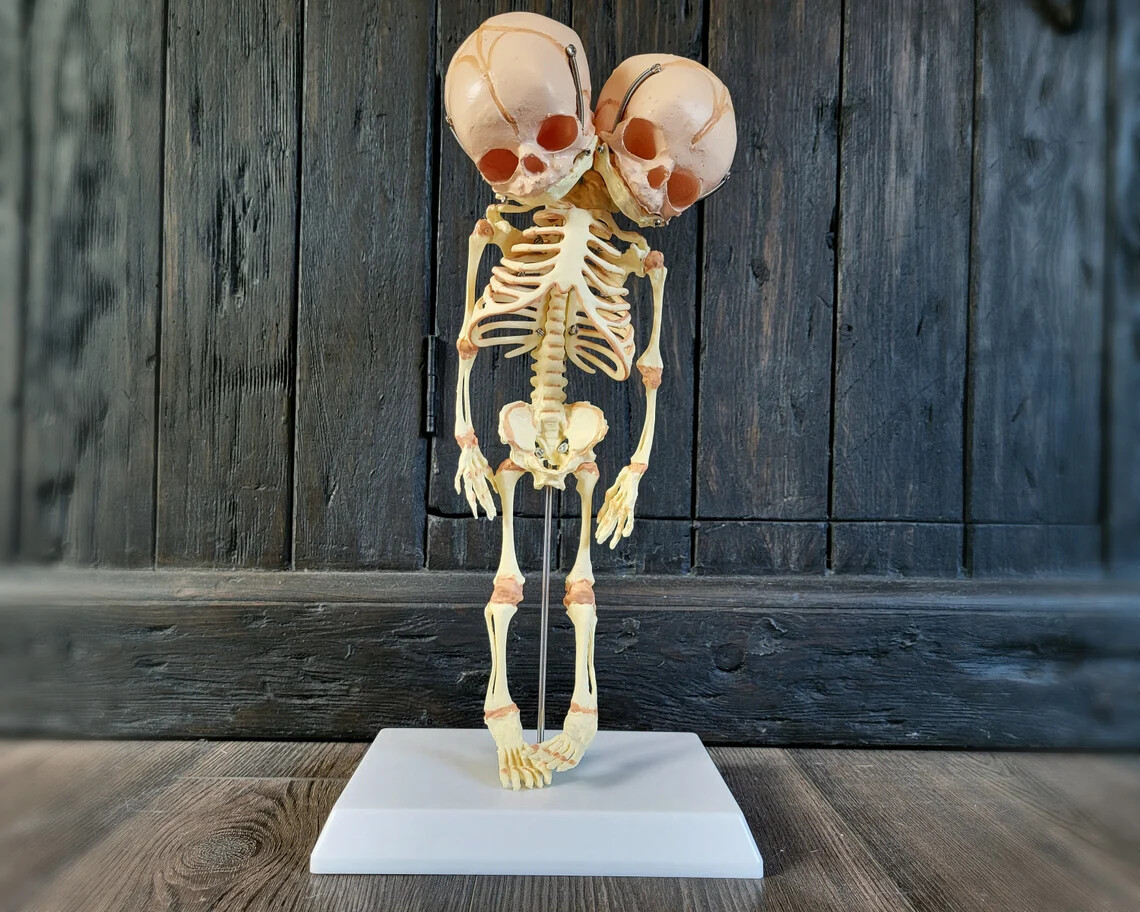 2 Headed Fetal Skeleton, Conjoined Twins Skeleton Model, 2 Head Baby, Oddities