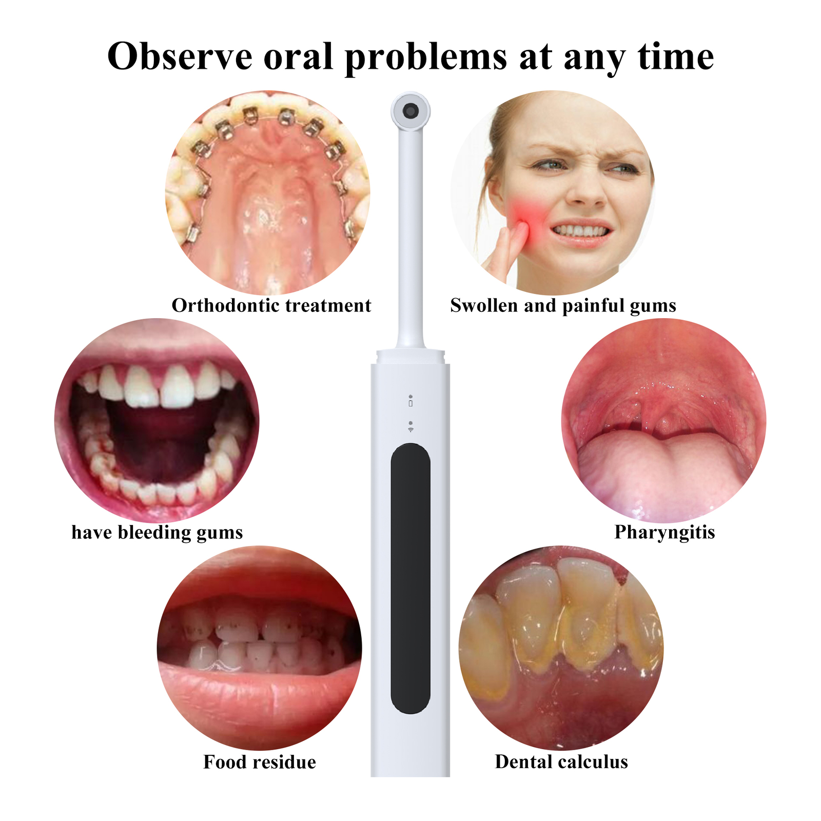 Dental 1080P Wireless Oral Camera 8 LEDs HD Digital Imaging Intraoral Endoscope