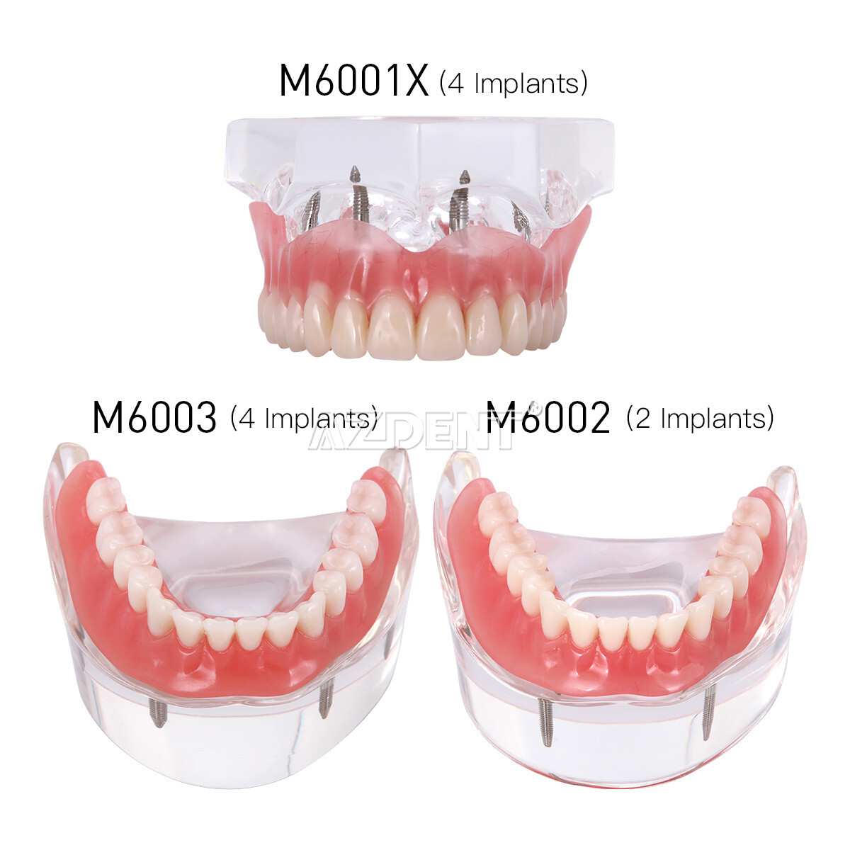 Dental Overdenture Implant Teeth Model Denture with implant Demonstration Clear