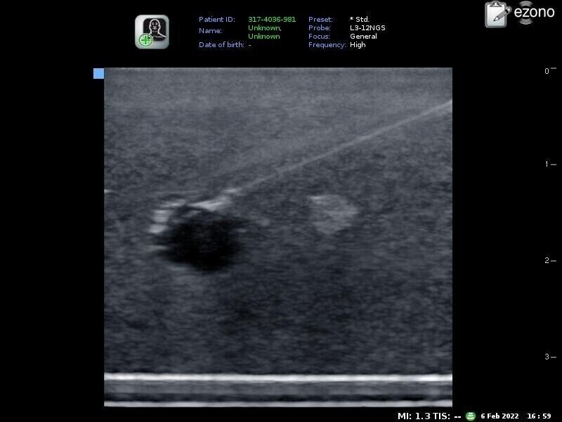 4 set simple ultrasound phantom training model-nerve and vessel