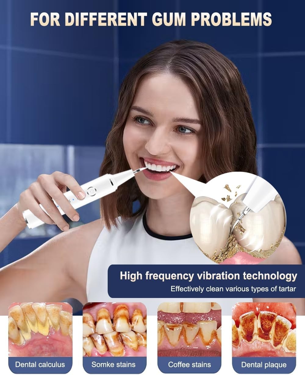 Electric Ultrasonic Dental Calculus Tooth Cleaner LED Scaler Plaque Remover Tool