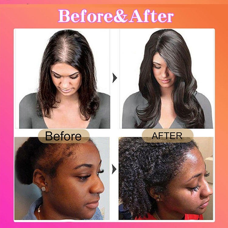 100% Natural Batana Oil For Hair Growth -Anti Hair Loss-Healthier Thicker Fuller