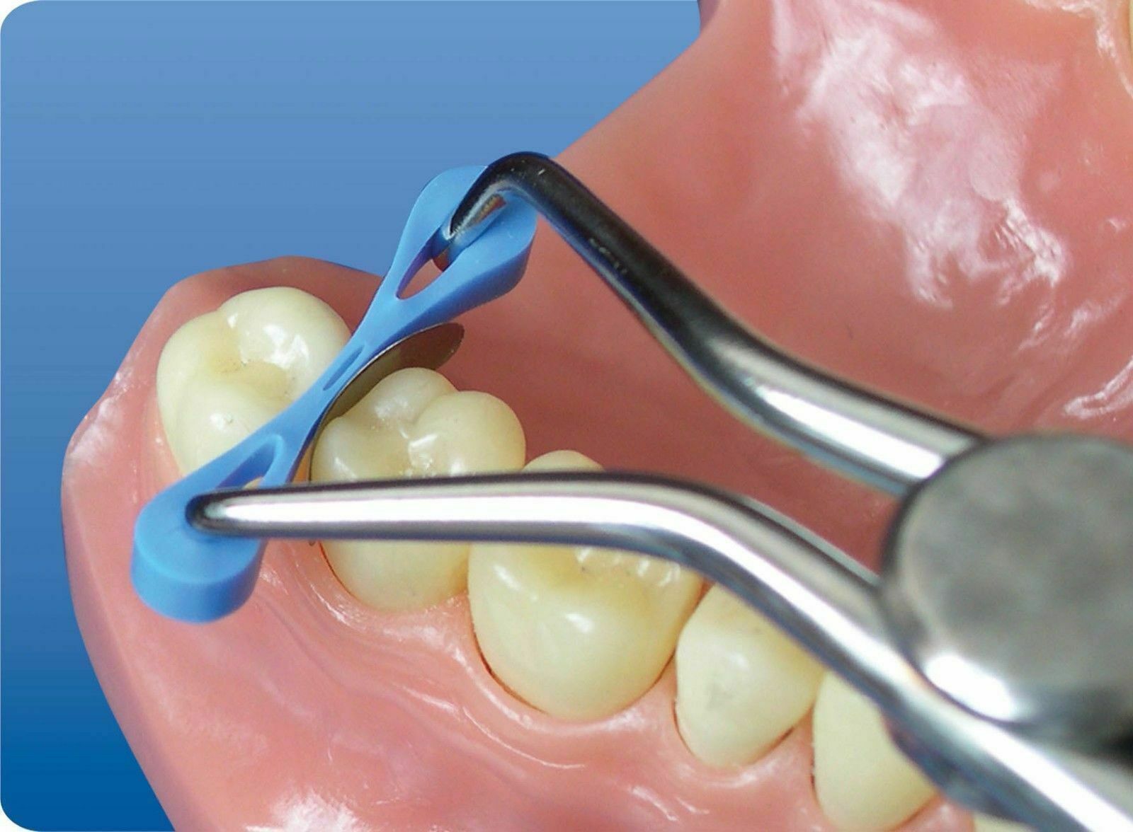 Dental Elastic Fixing Wedges Composite Soft & Hard Matrix Matrices Rubber Dam