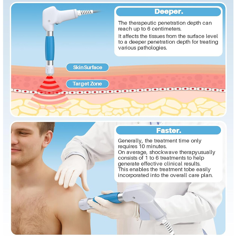 Kalecope Pneumatic ED Shockwave Therapy Machine Muscle Joint Pain Relief Massage