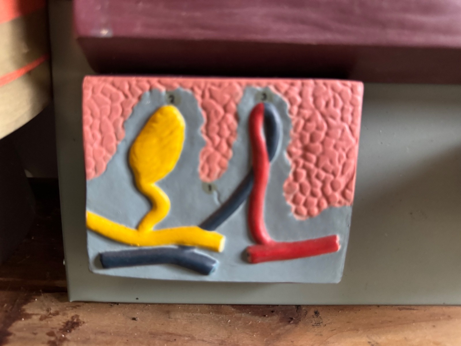 Vintage anatomical model of SKIN Hair follicle & sweat glands