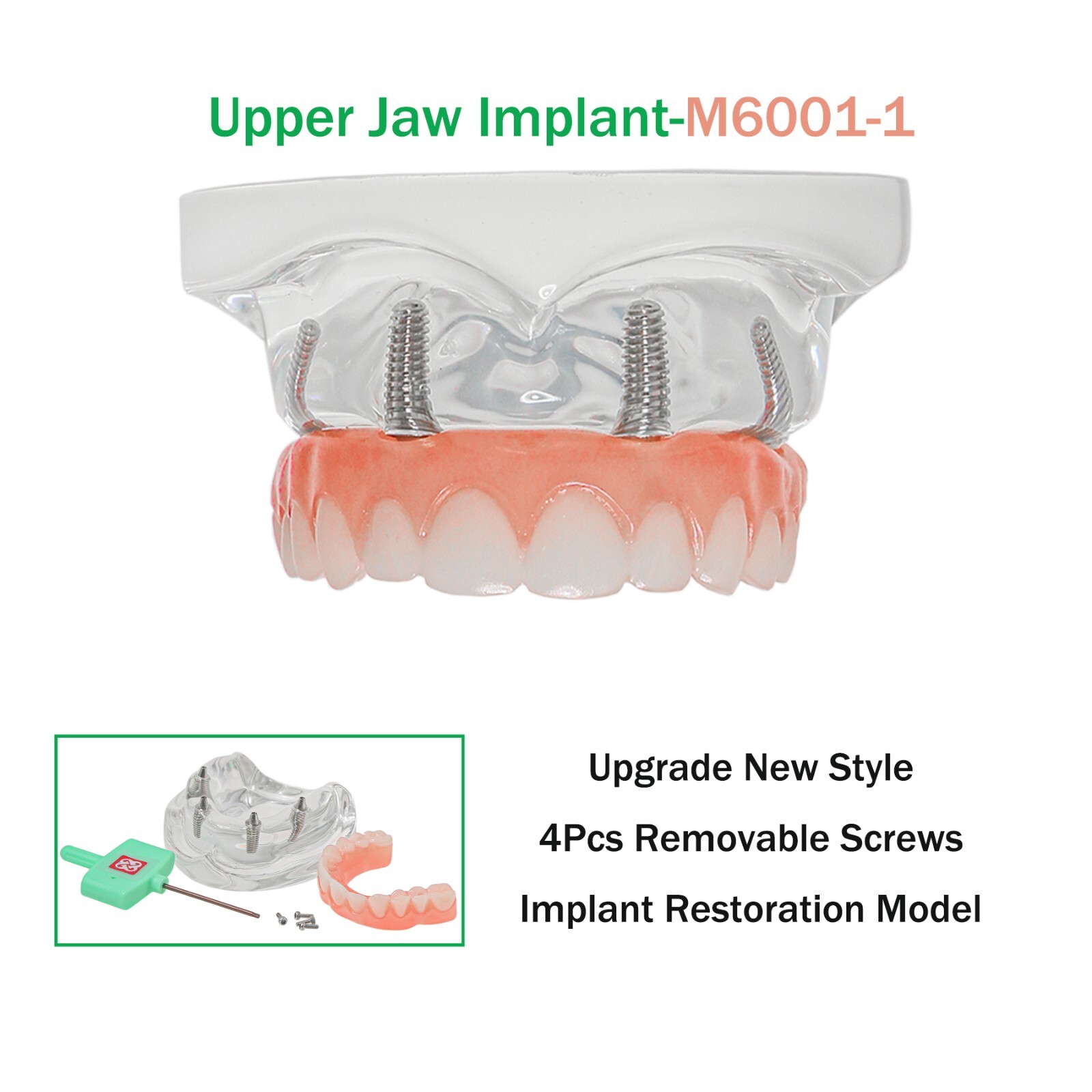 All-on-4/6 Dental Implant Model Upper/Lower Jaw Removable Screws Transparent