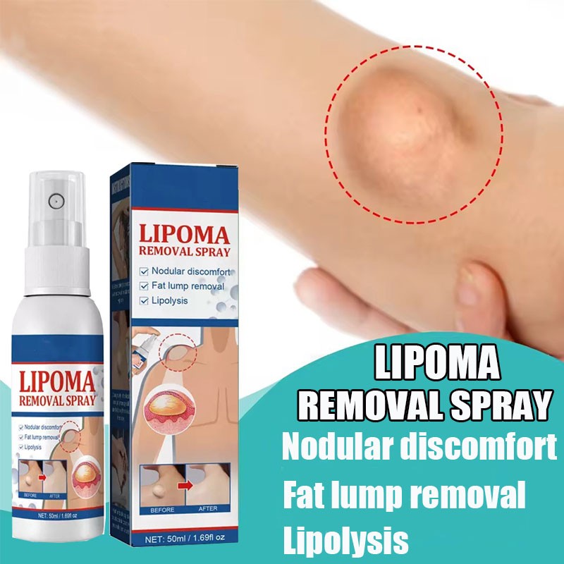 50ML Lipomheilung Reduction Spray, Instant LumpFree Lipoma Removal Spray