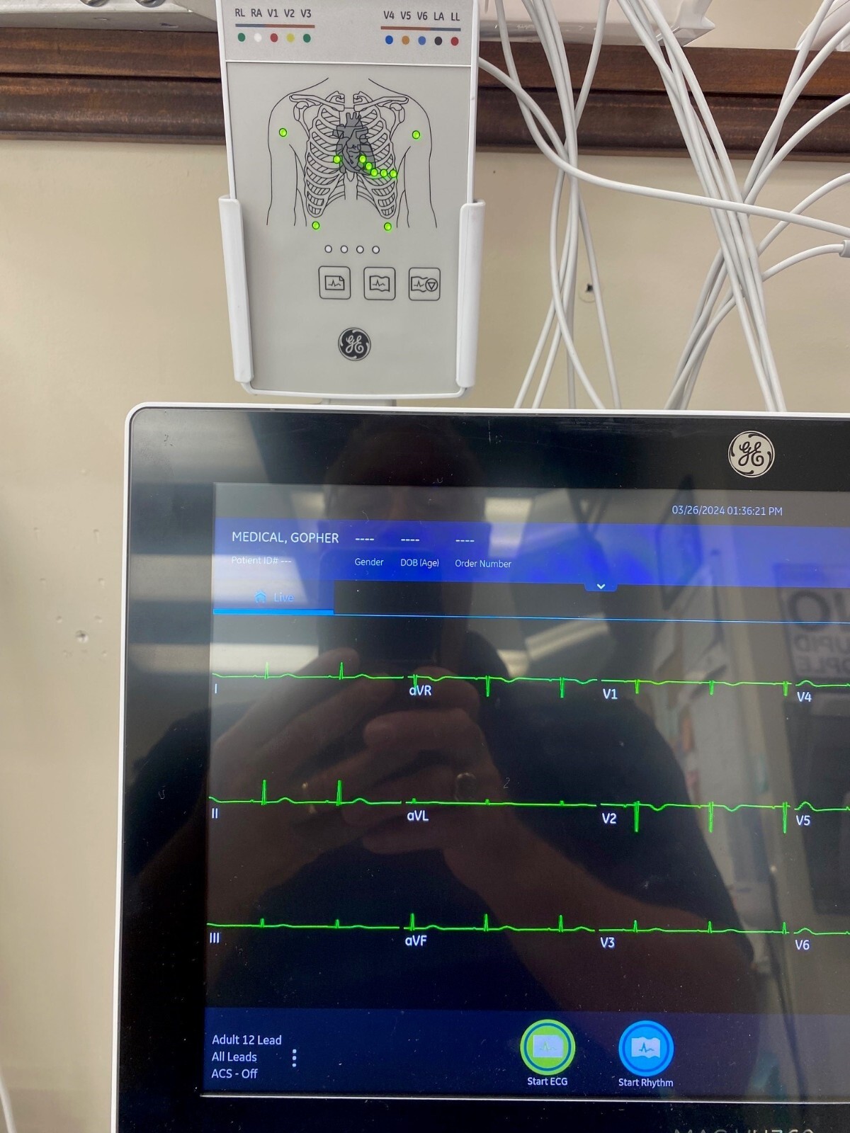 GE CAM Connect 14 Module 2091686-001 Biomed Tested on Mac Vue360 with Warranty