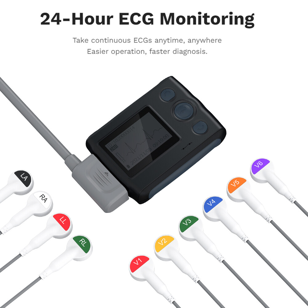 12 Lead Holter Monitor Recording 24h ECG and Heart Rate AI Analysis Abnormal ECG