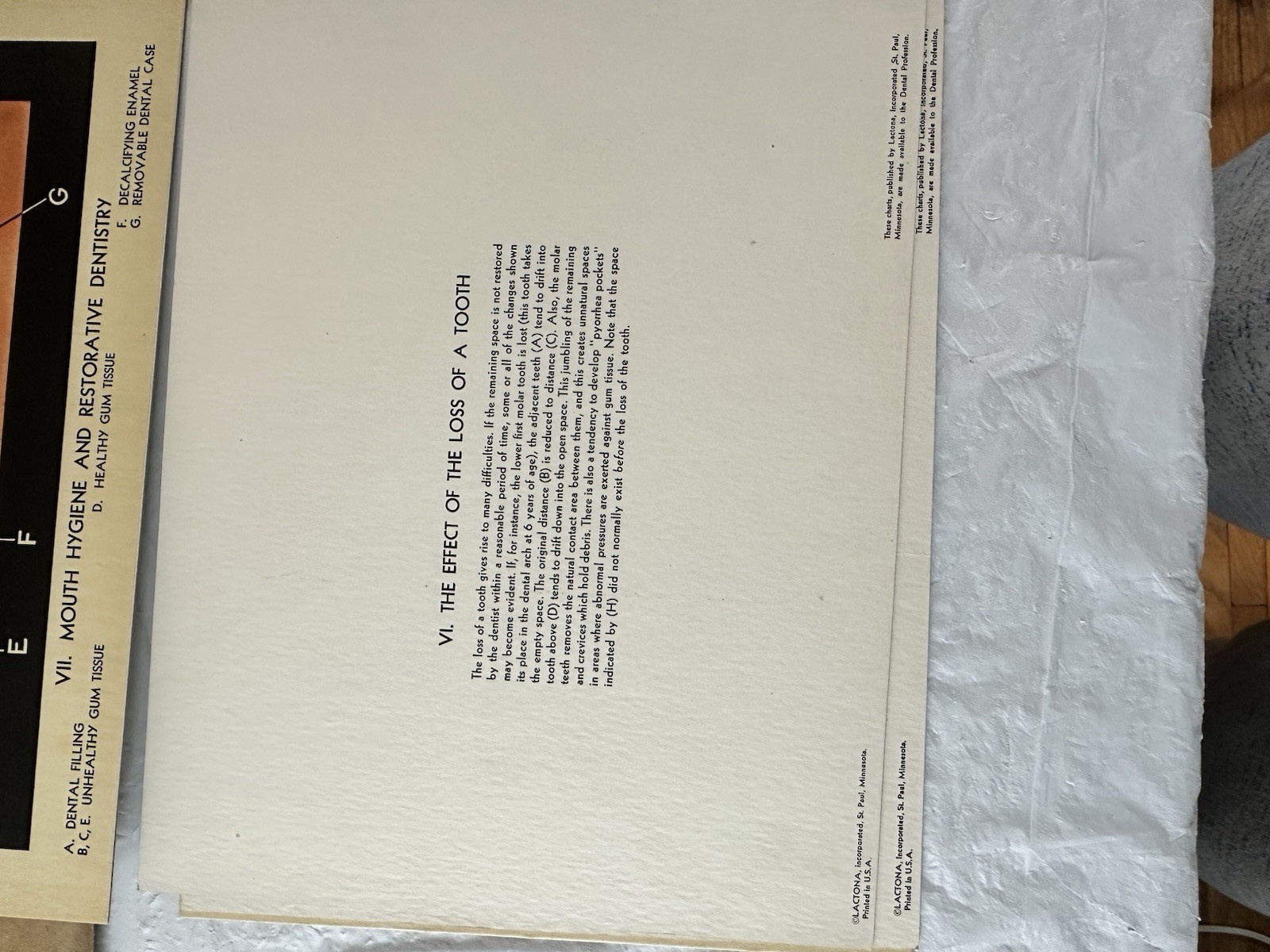 Vintage Lactona Inc Dental Anatomy Diagram Prints 11X8.5 Inches Dentistry